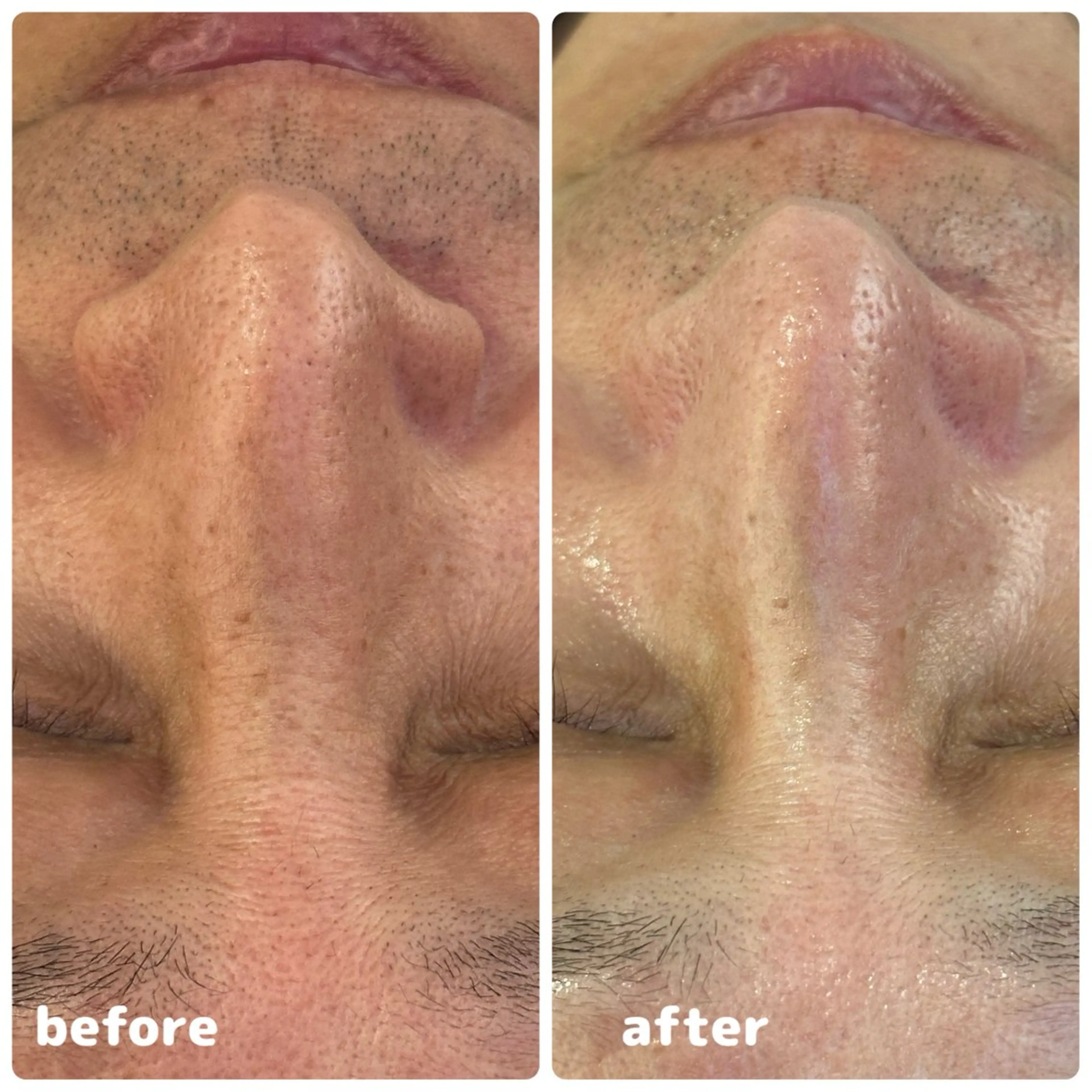 メンズ エステ LILY E所属・LILY Eのエステ・リラクイメージ