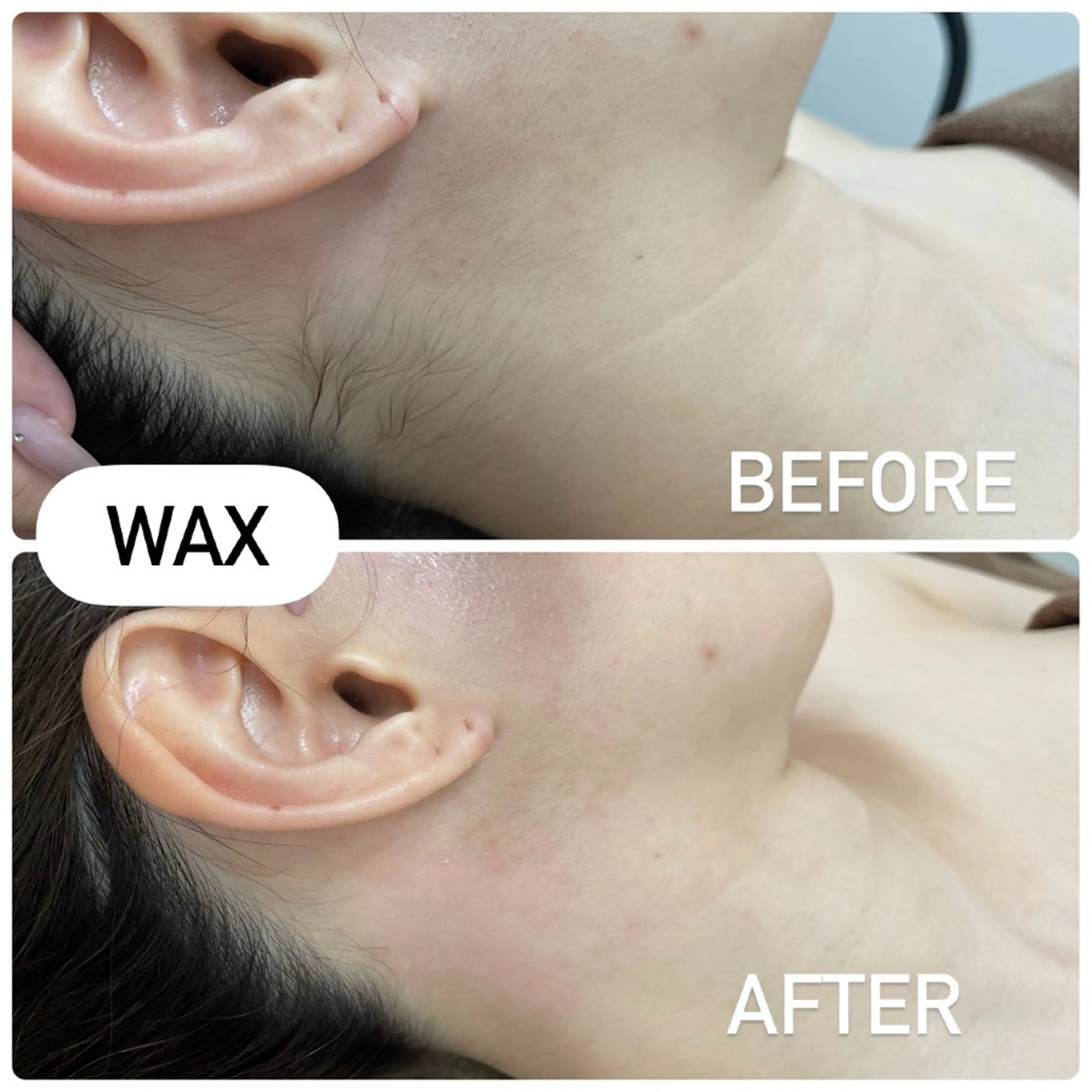 脱毛 MIRUS所属・脱毛サロンMIRUS Yuukaのエステ・リラクイメージ