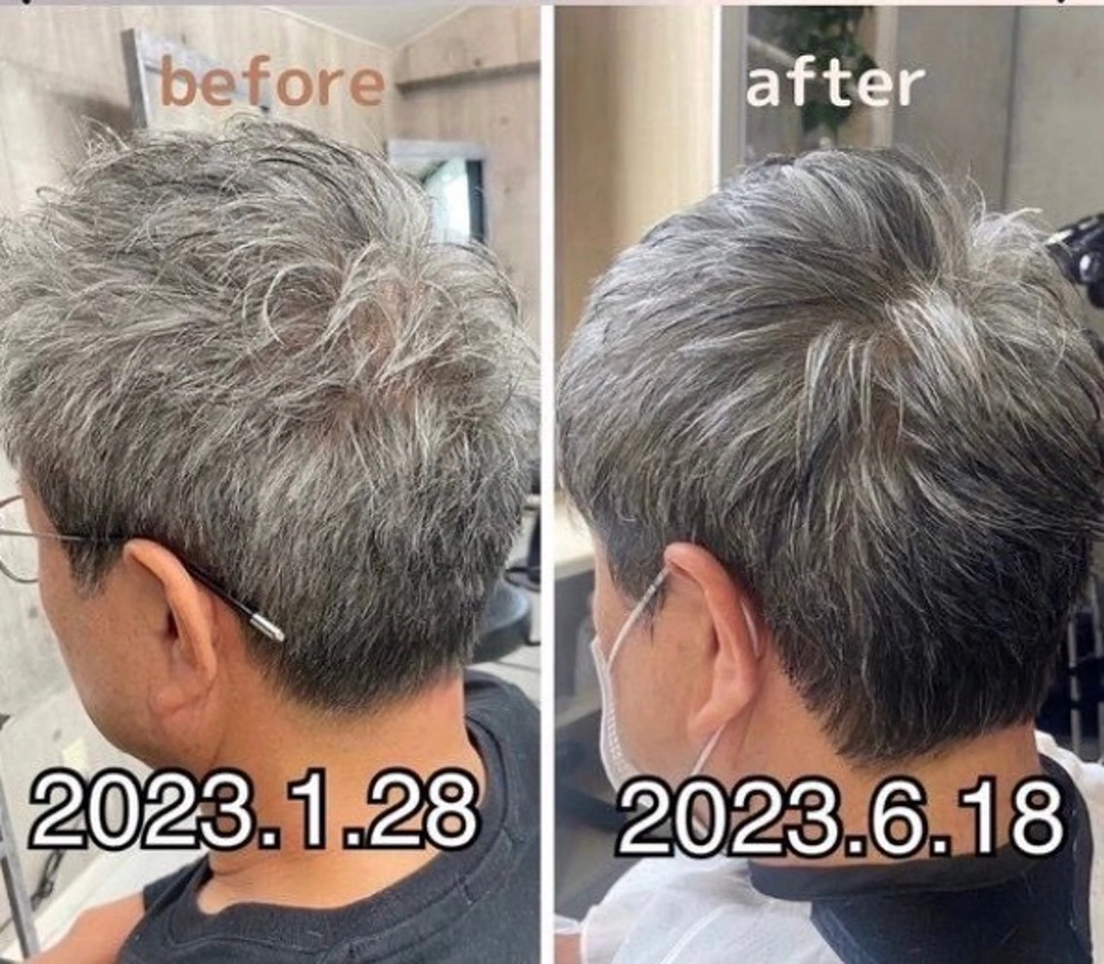 メンズ トリートメント ヘッドスパ 痩身・脱毛・美髪ケア 【GLYCINE】のエステ・リラクイメージ