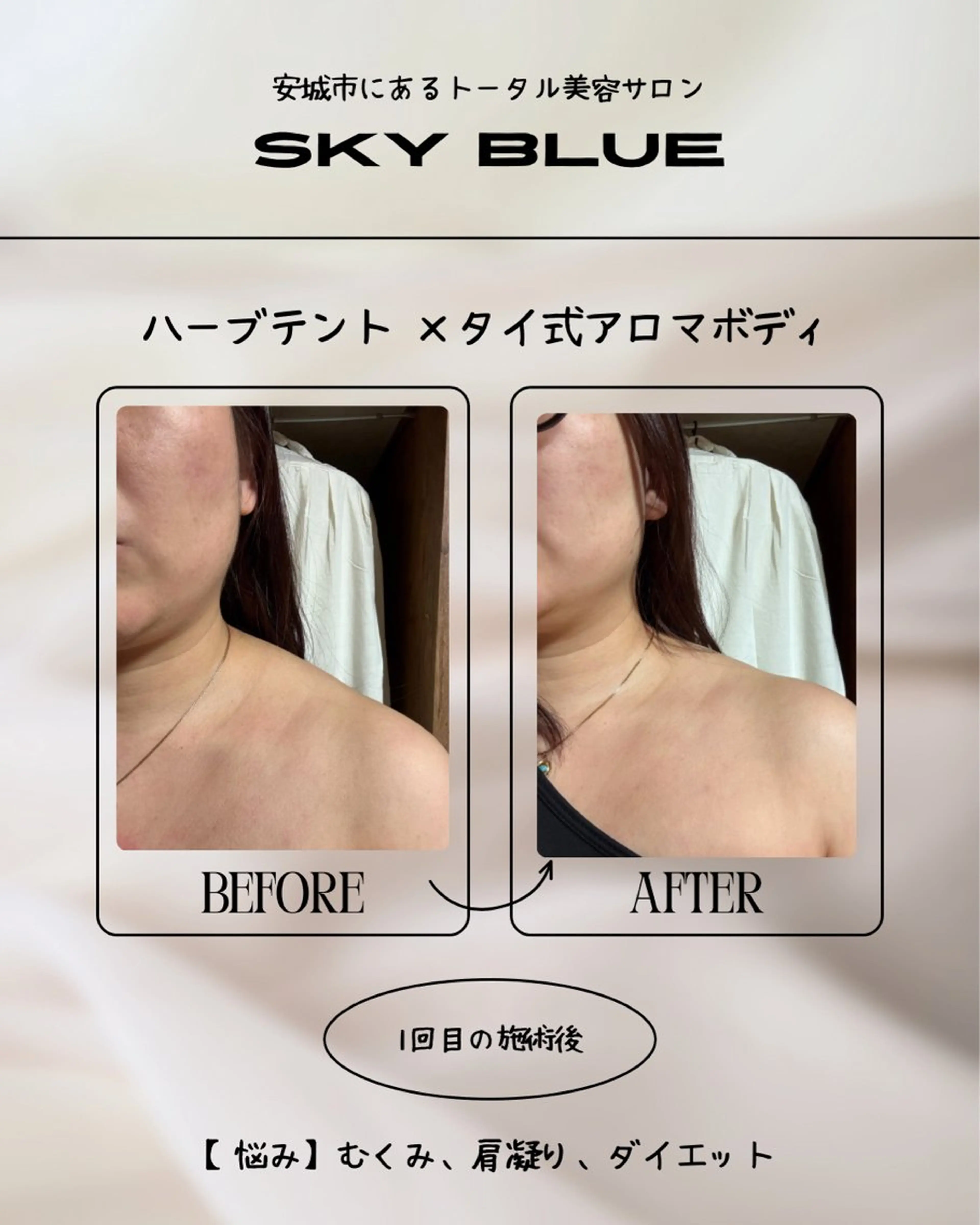 その他 SKY Blueのその他イメージ