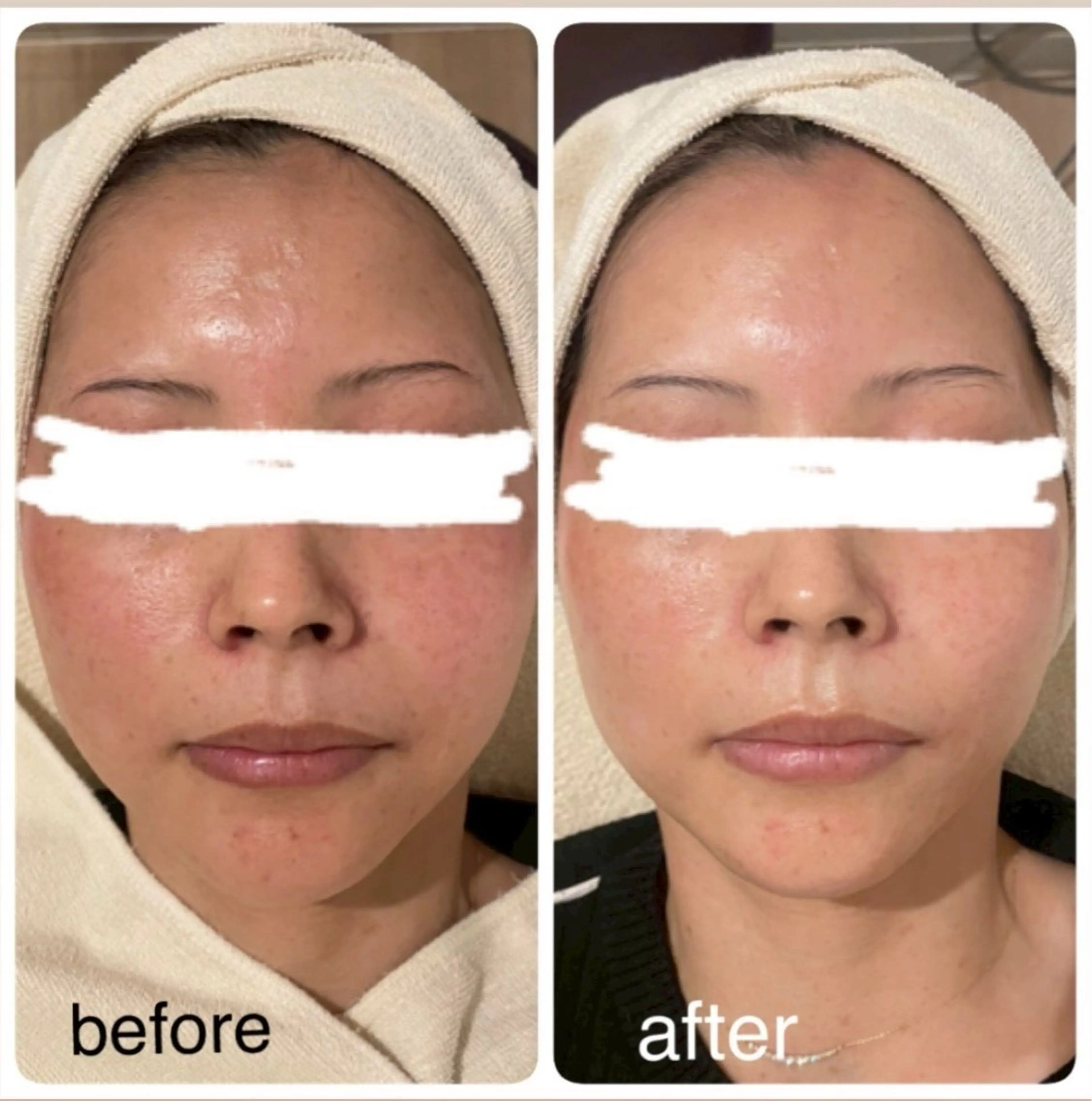 日髙 星奈のエステ・リラクイメージ