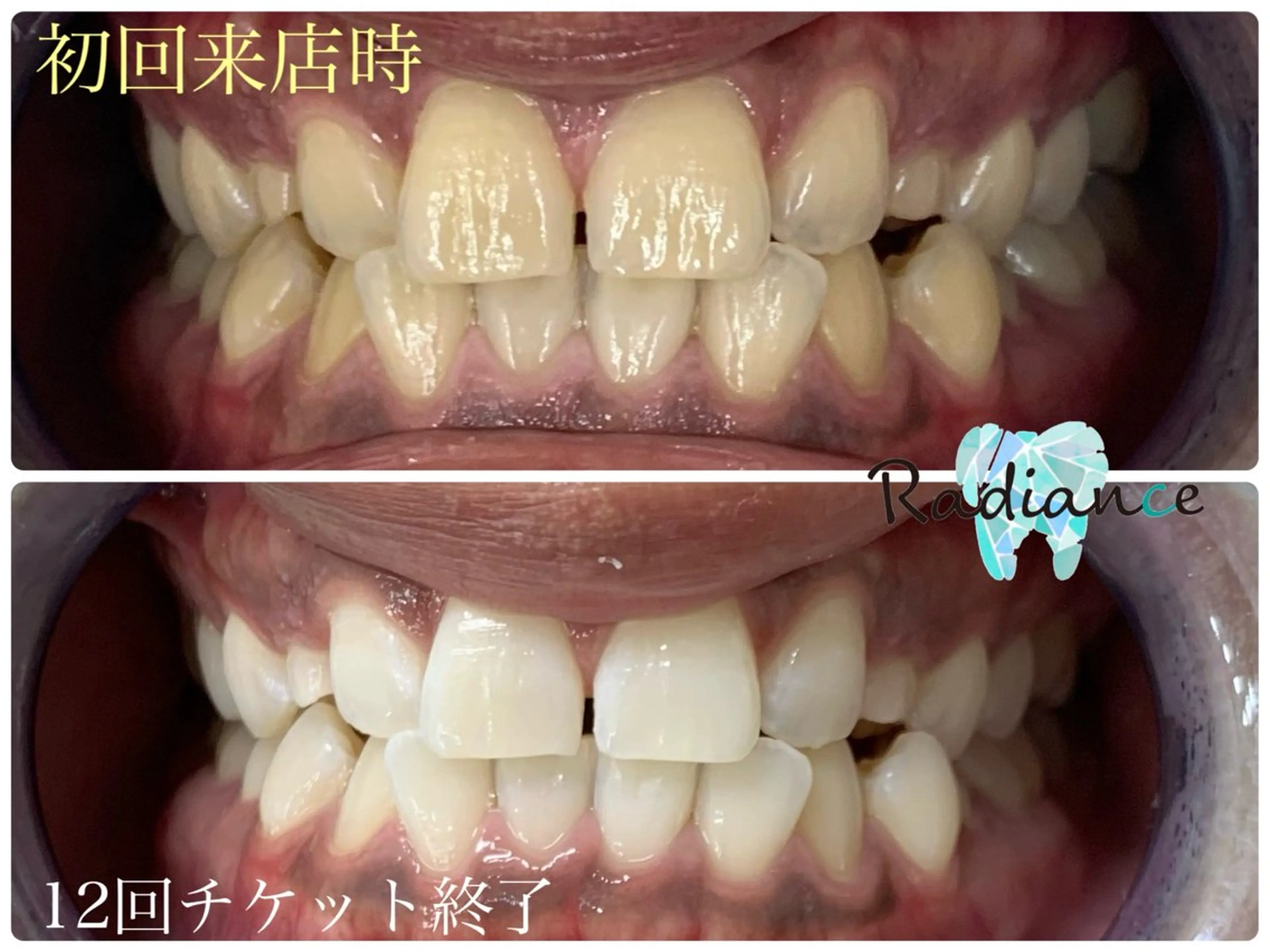 札幌ホワイトニング ラディアンス札幌駅店のその他イメージ