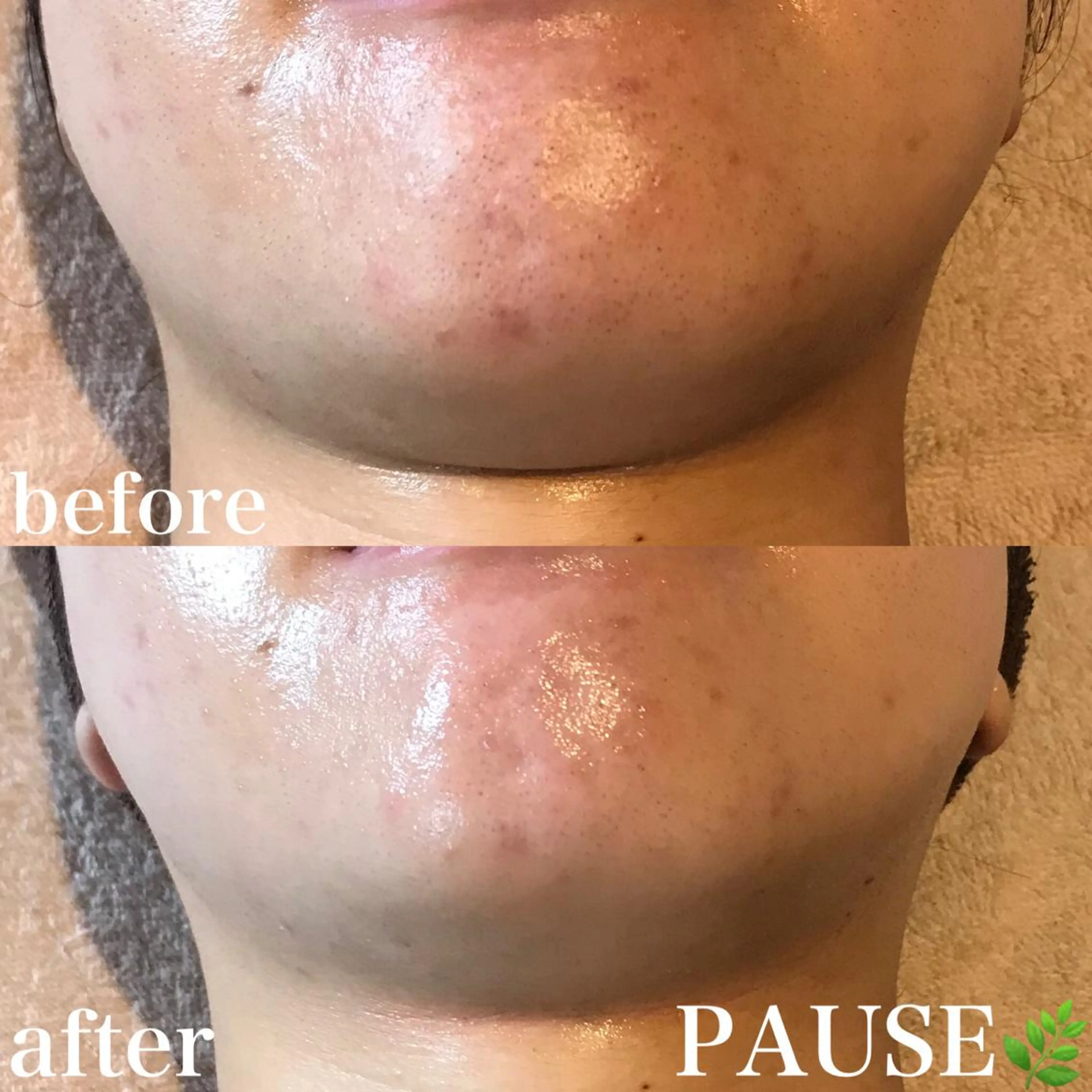 エステ 浜野 恵美のエステ・リラクイメージ