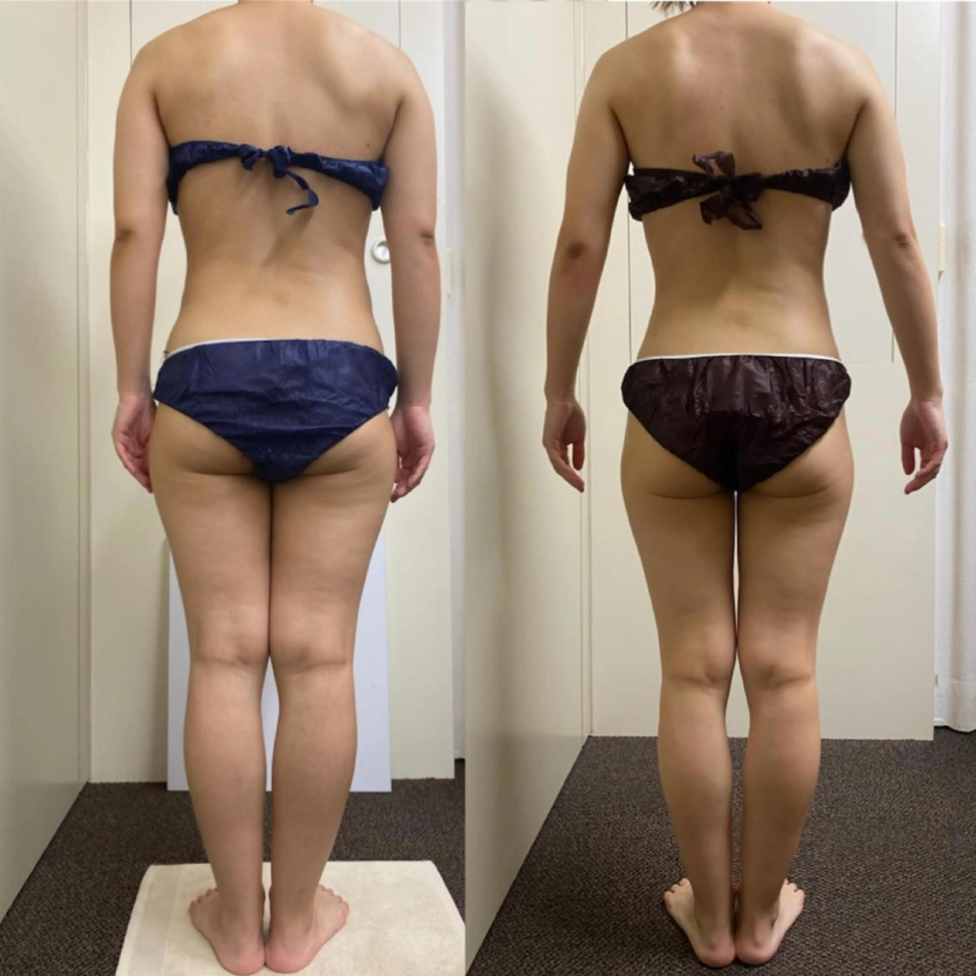 RAYVIS梅田店 FUJIのエステ・リラクイメージ