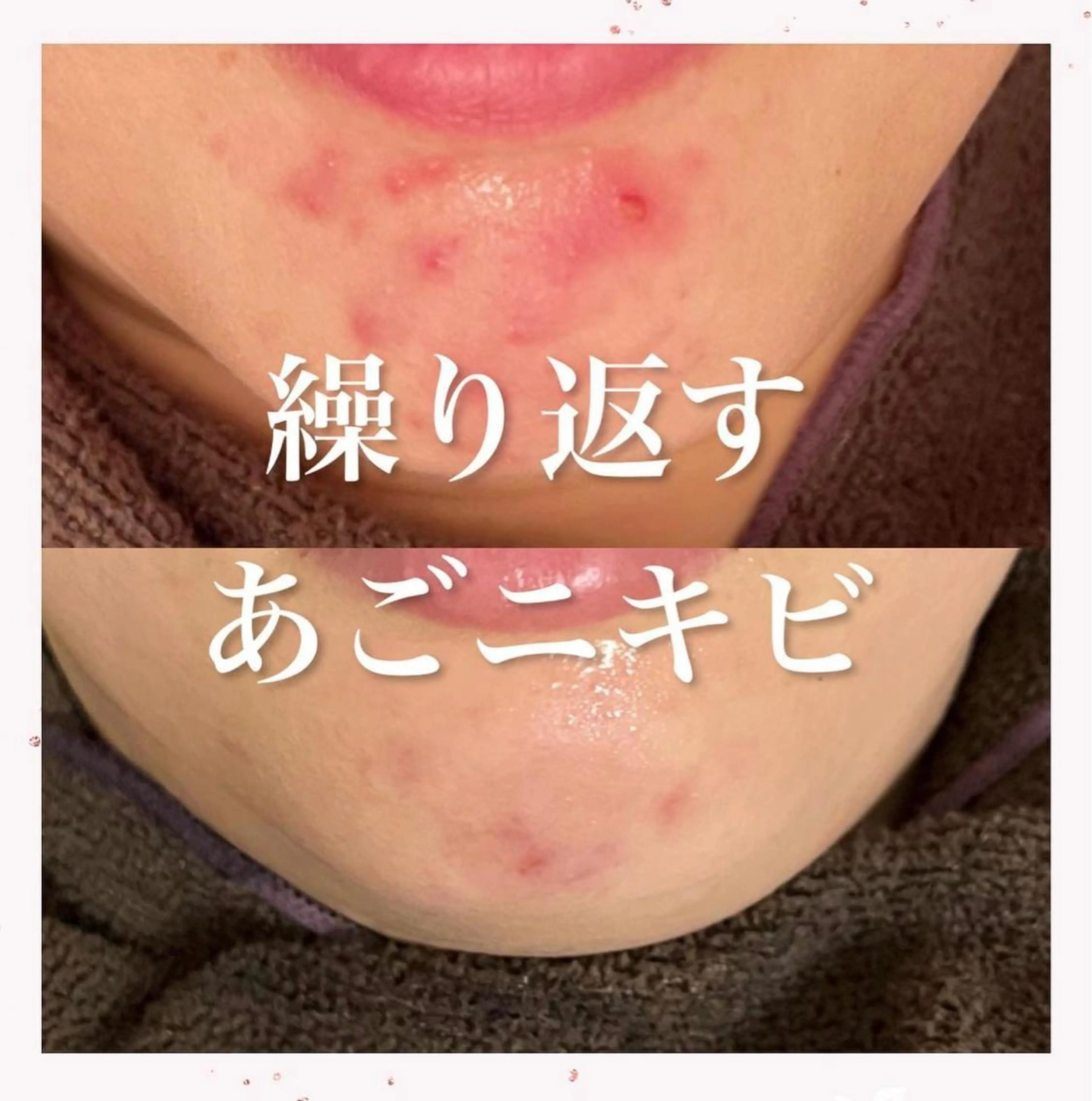 セミロング カラー パーマ ヘアアレンジ メンズ キッズ ネイル マツエク・マツパ アイブロウ 赤色 エステ リラク ニキビ跡専門サロン Ａｉｎａのエステ・リラクイメージ