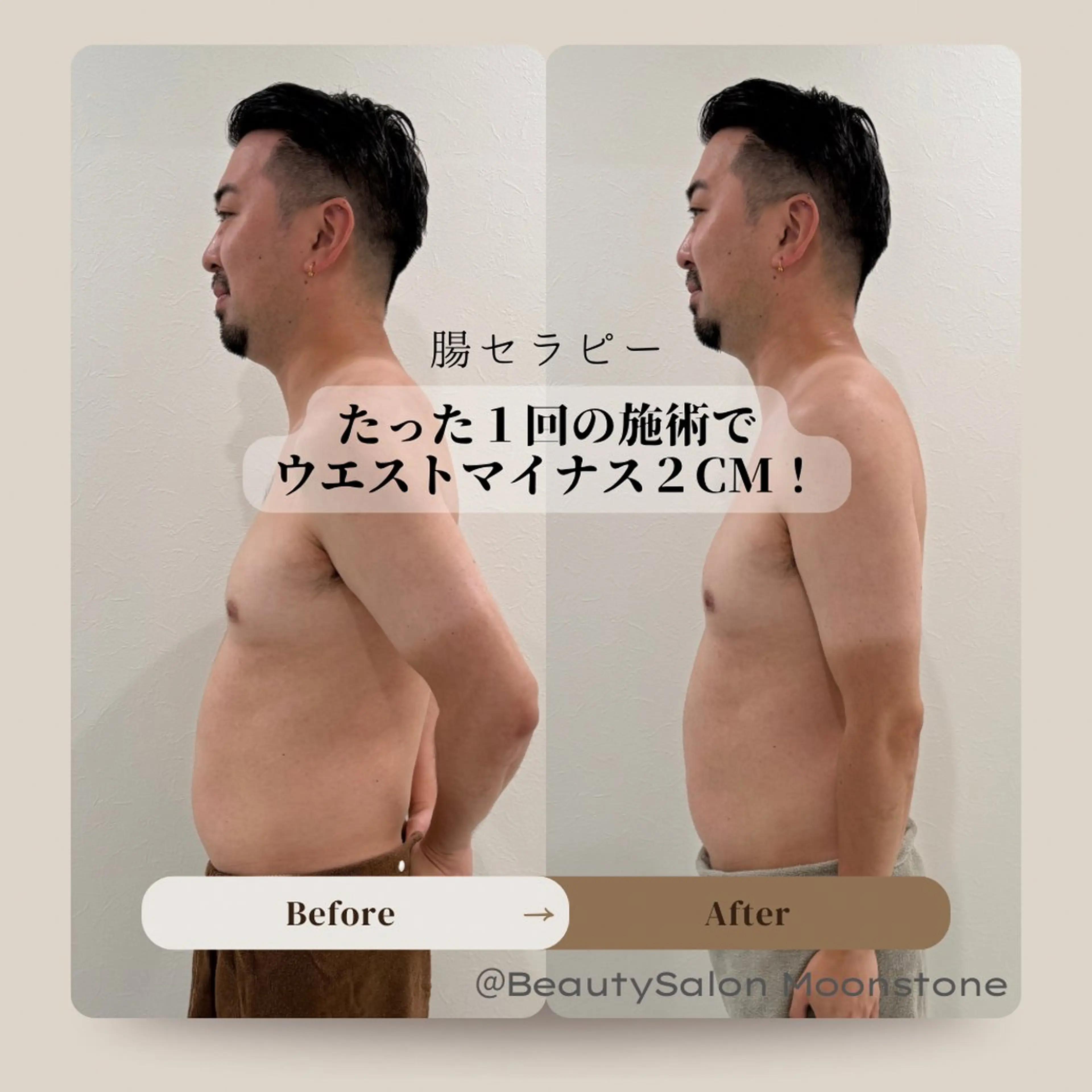 Beauty Salon Moonstone所属・Moonstone 腸活ダイエット・脱毛のエステ・リラクイメージ