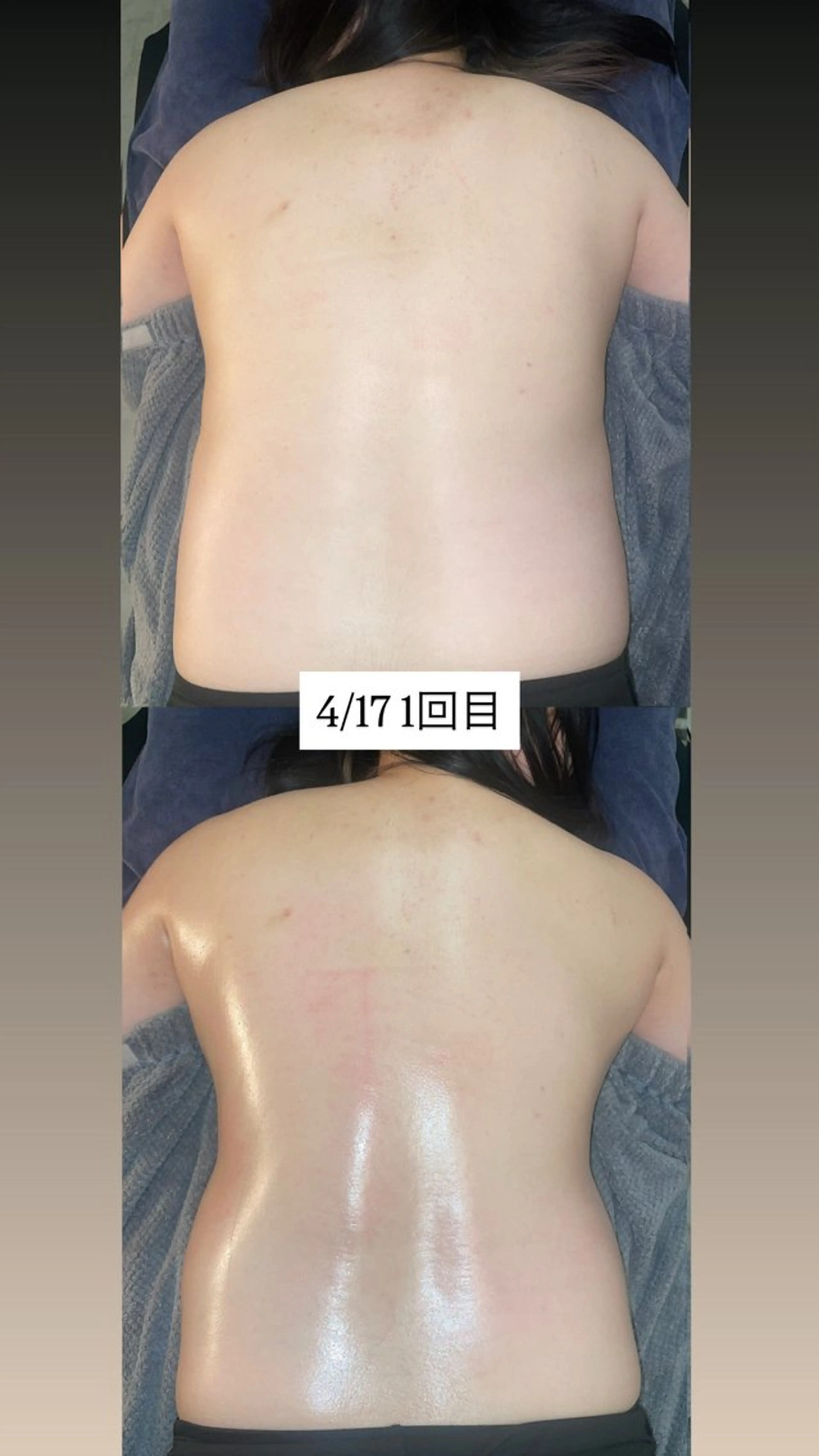 全身痩身コース🔥の写真