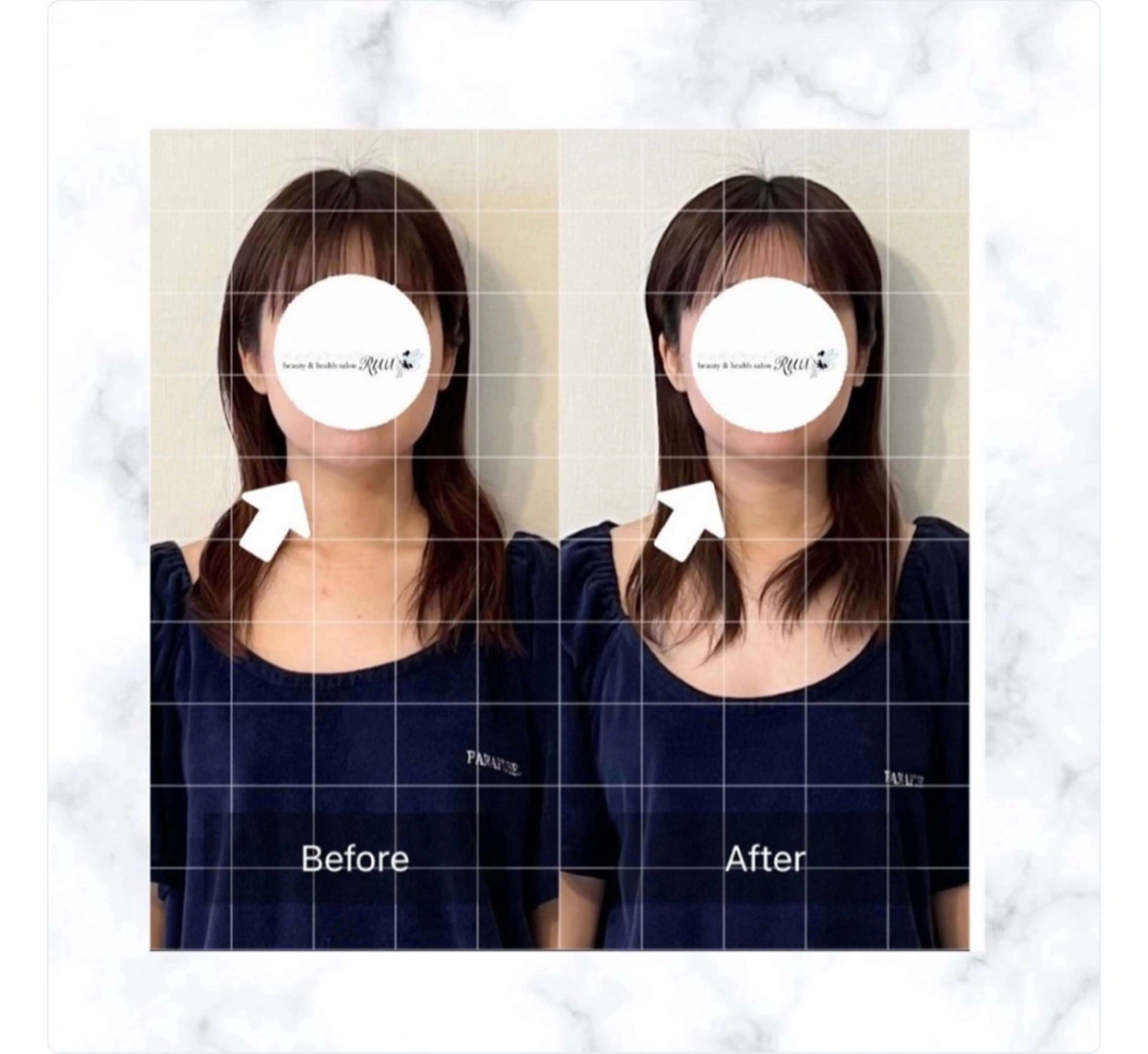 【頭痛、睡眠改善】 salon RUUのエステ・リラクイメージ