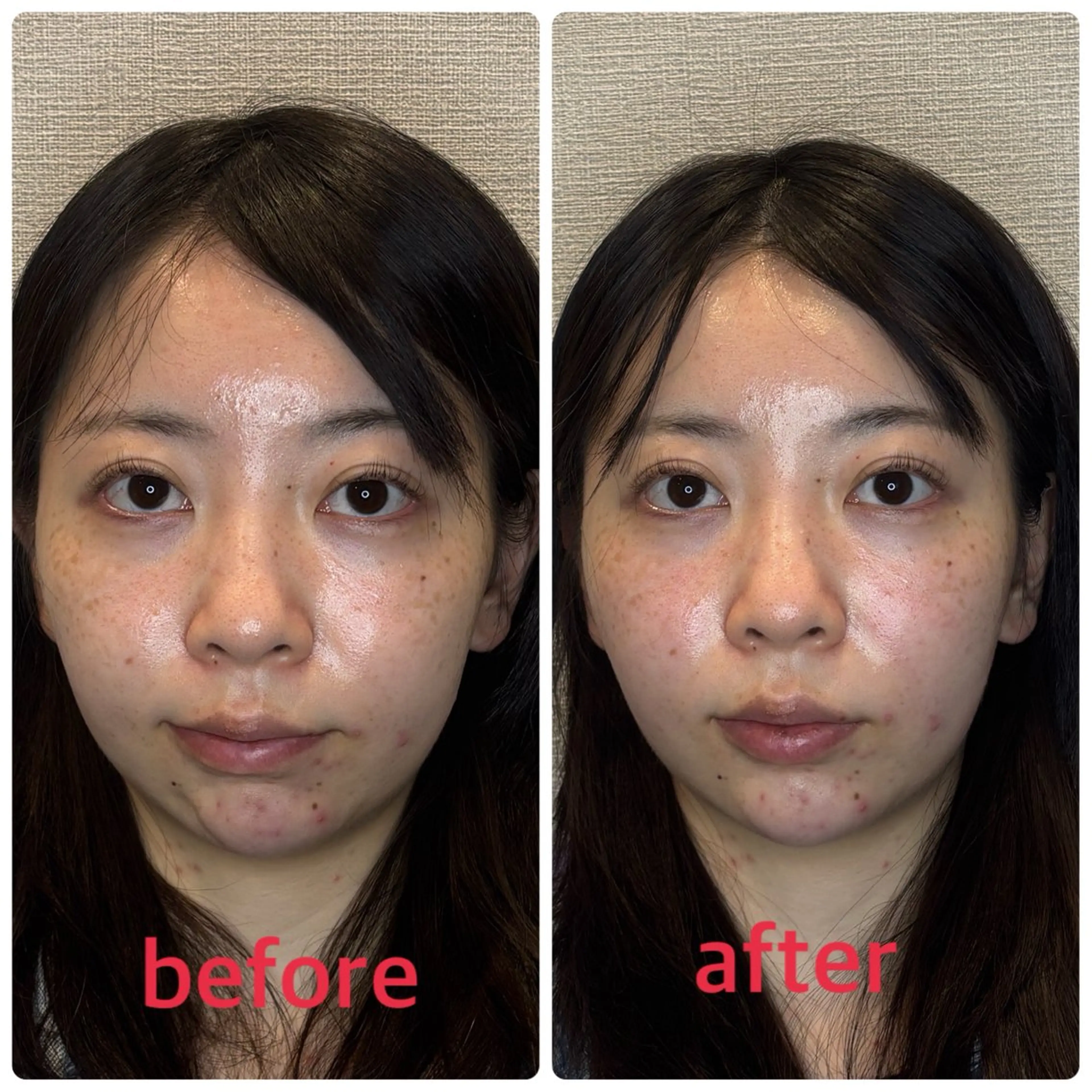 エステ リラク 小林整骨院本町 美容鍼roomのエステ・リラクイメージ