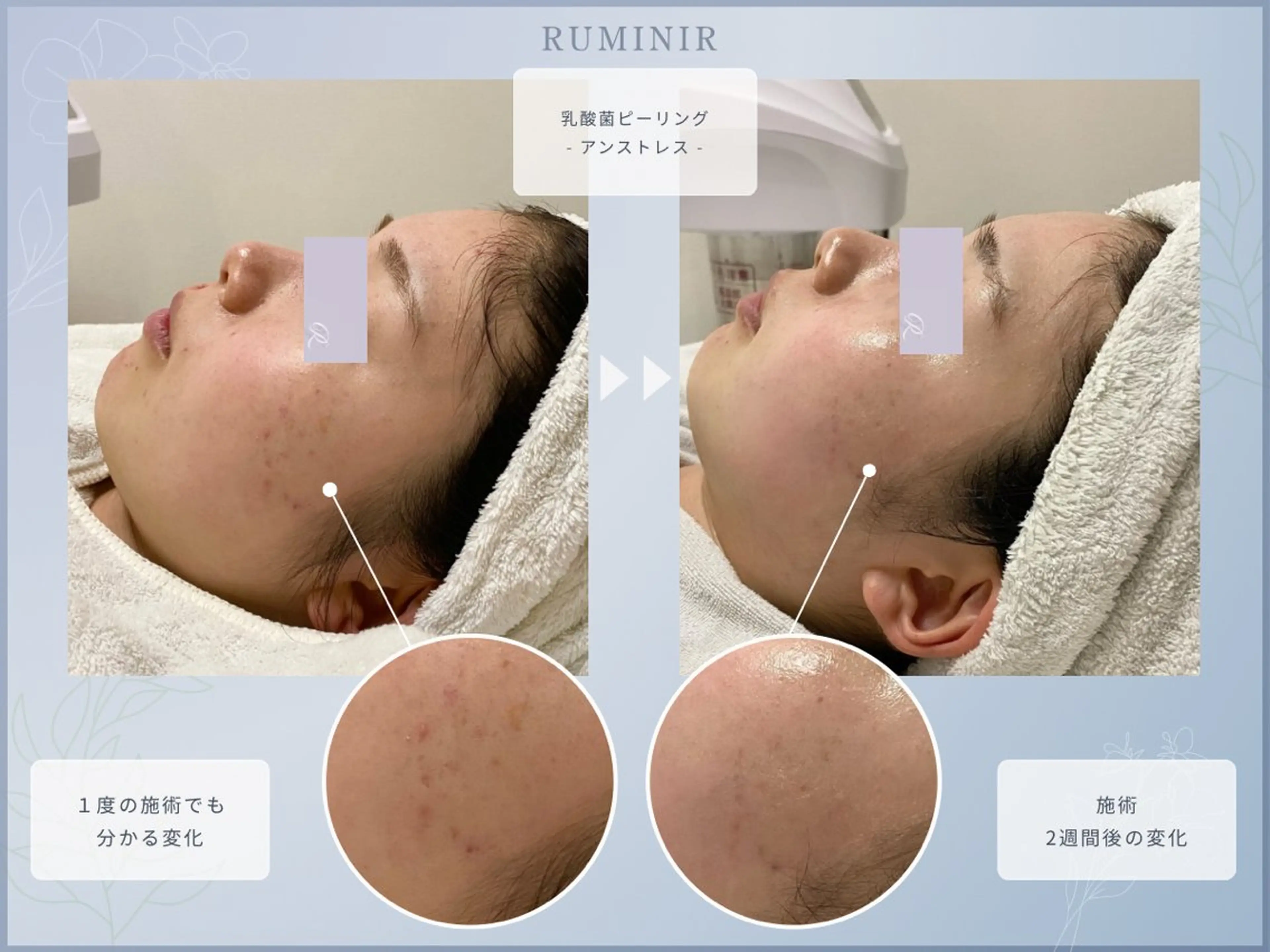 【肌質ケアサロン】 RUMINIRのエステ・リラクイメージ