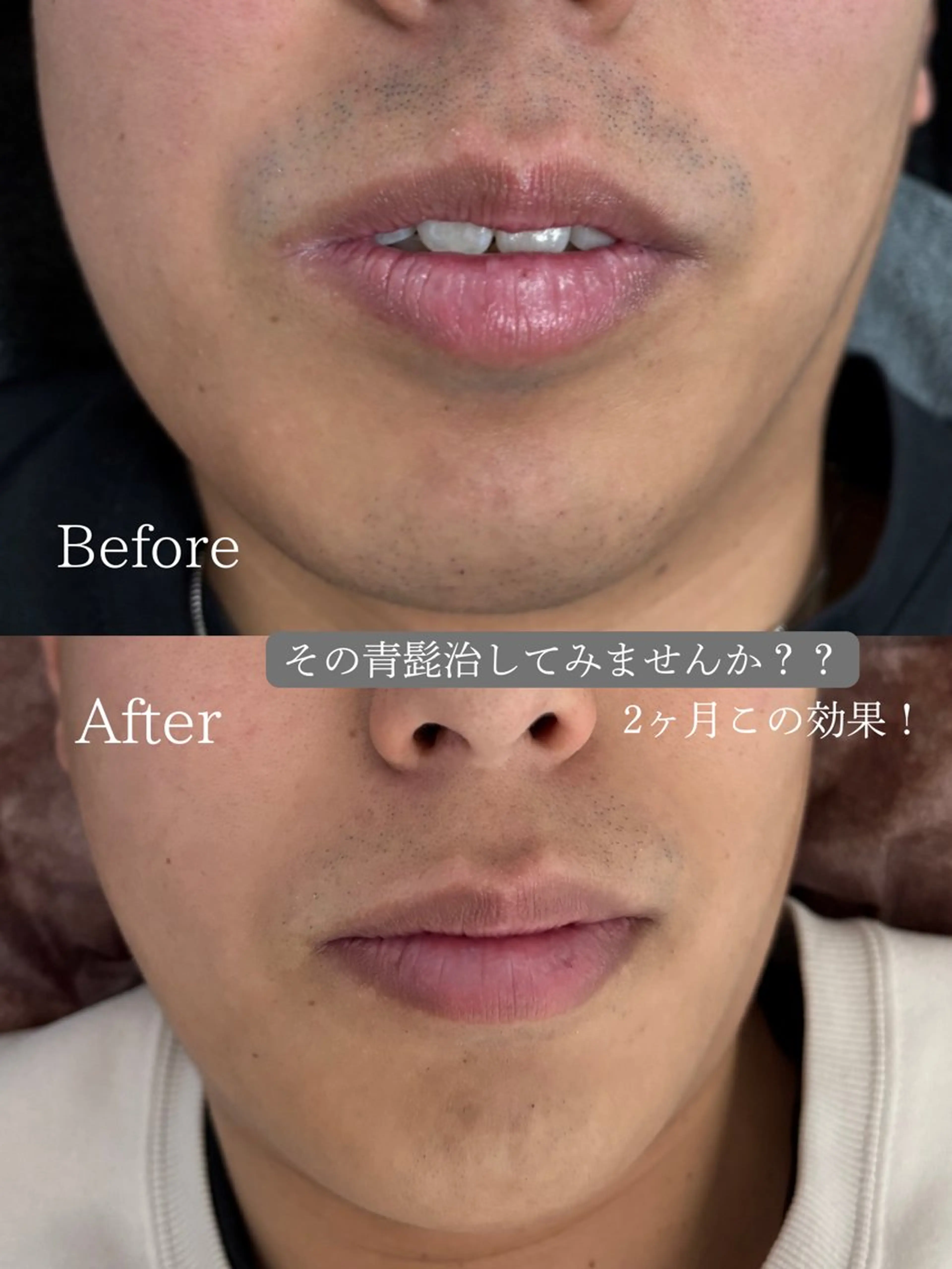 LIBRA心斎橋 セルフホワイトニングのその他イメージ