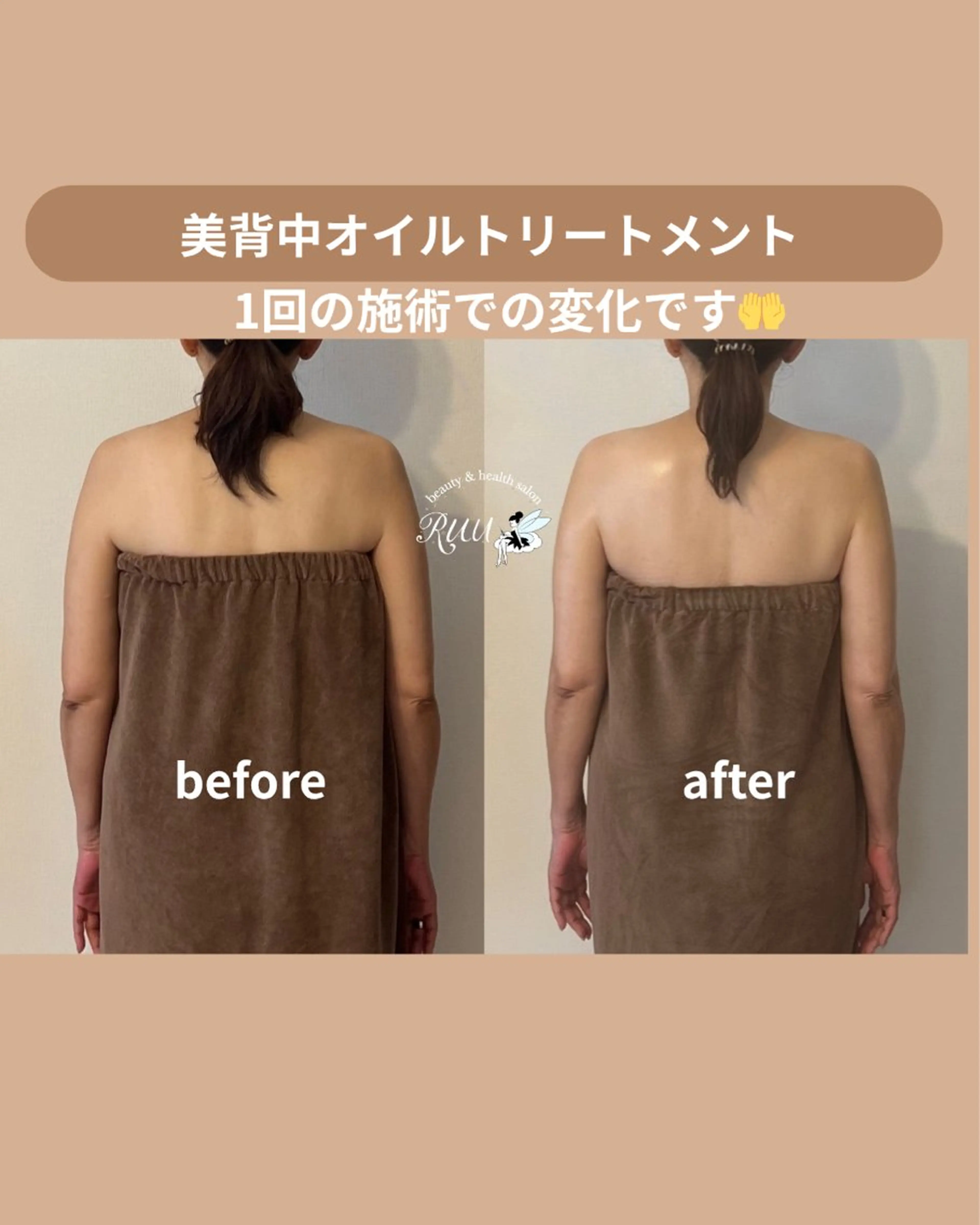 【頭痛、睡眠改善】 salon RUUのエステ・リラクイメージ