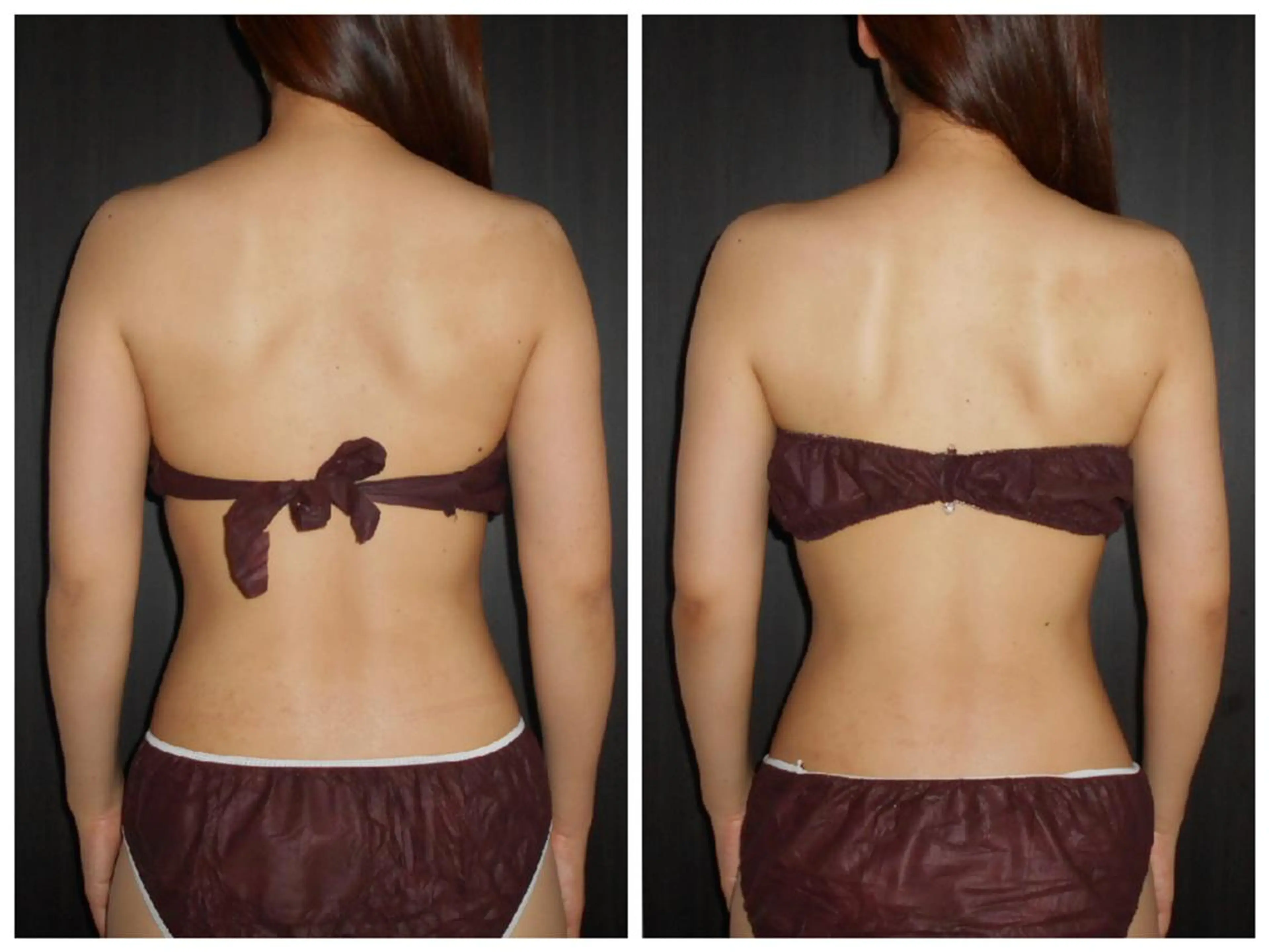 美肌脱毛専門店 イオンモール春日部店のエステ・リラクイメージ