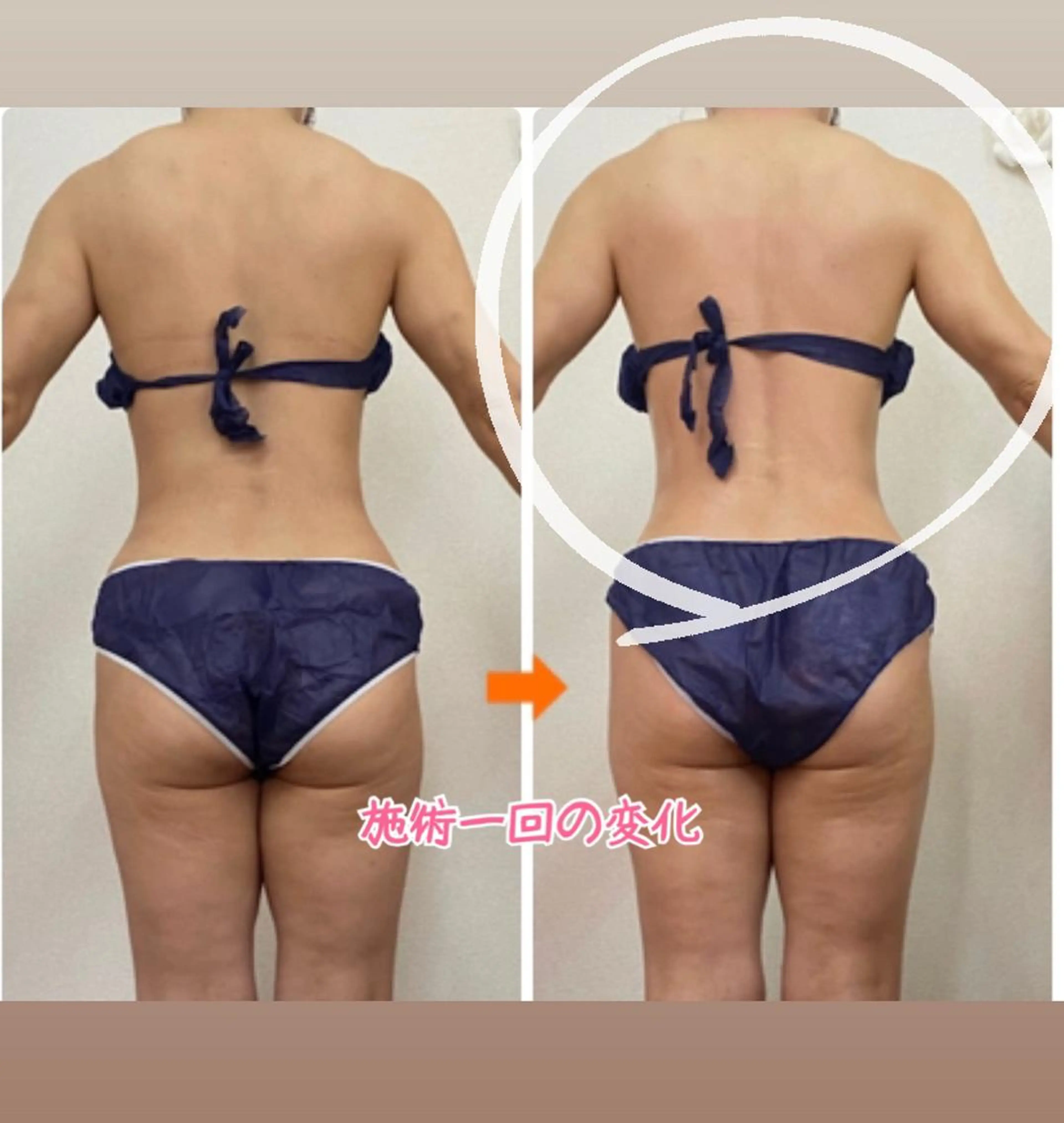 ショート カラー パーマ ヘアアレンジ メンズ キッズ ネイル マツエク・マツパ エステ リラク ‍痩身＆ボディ 結果出し🌟丹野のエステ・リラクイメージ