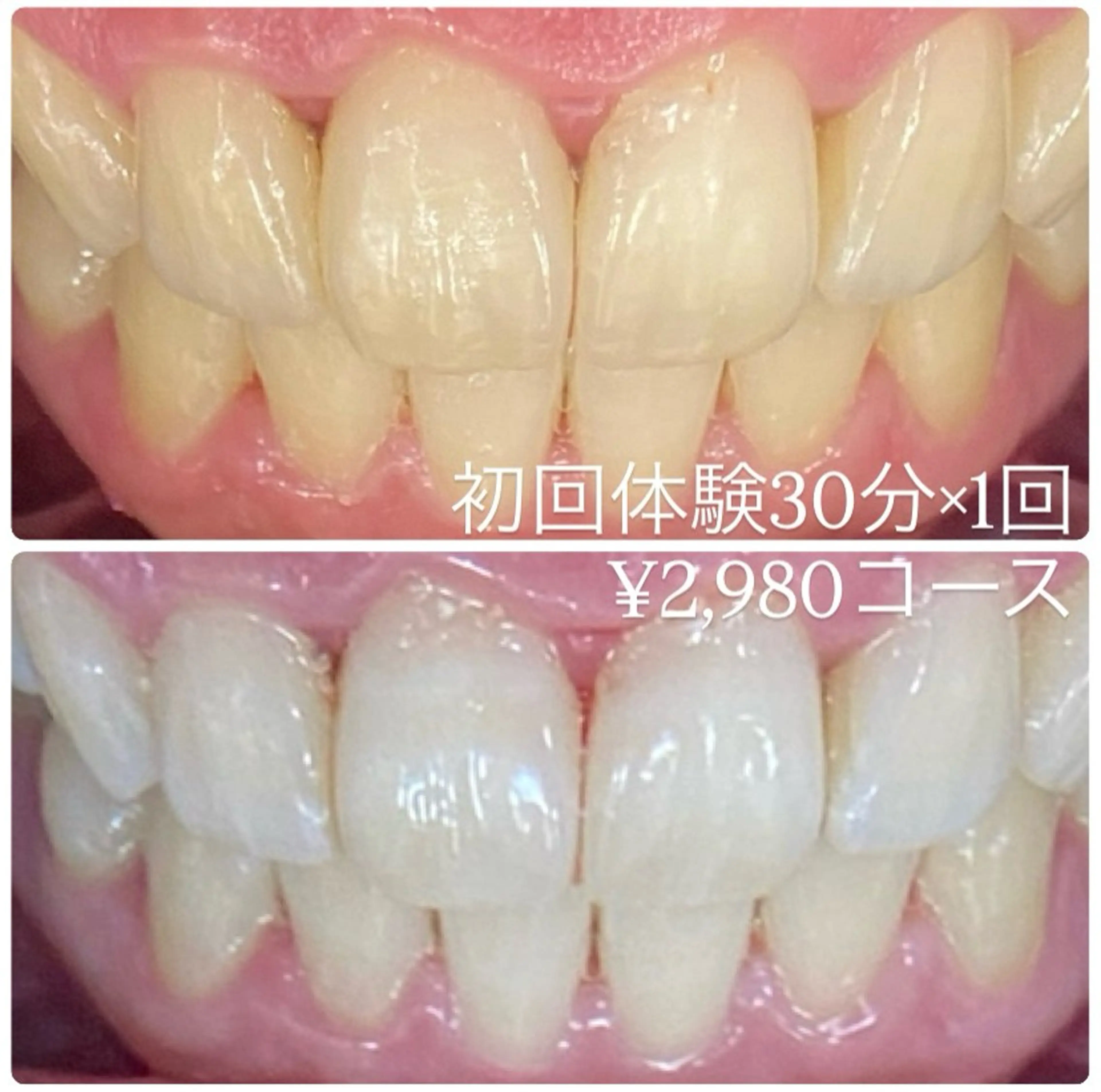 PLATINUM Beauty 横浜店所属・ホワイトニングルーム 横浜店のその他イメージ