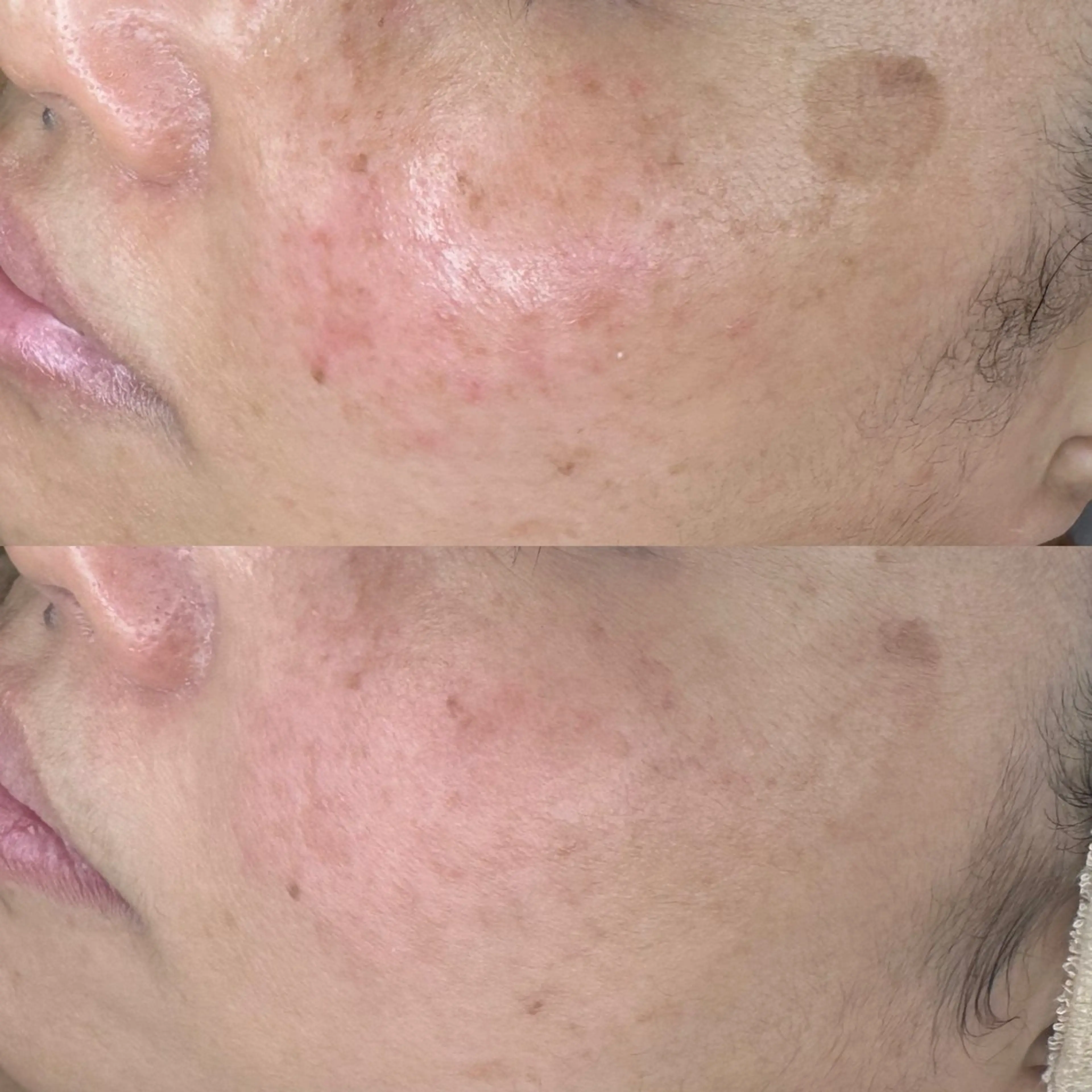 エステ シミケア専門サロン 10POINT.Kのエステ・リラクイメージ