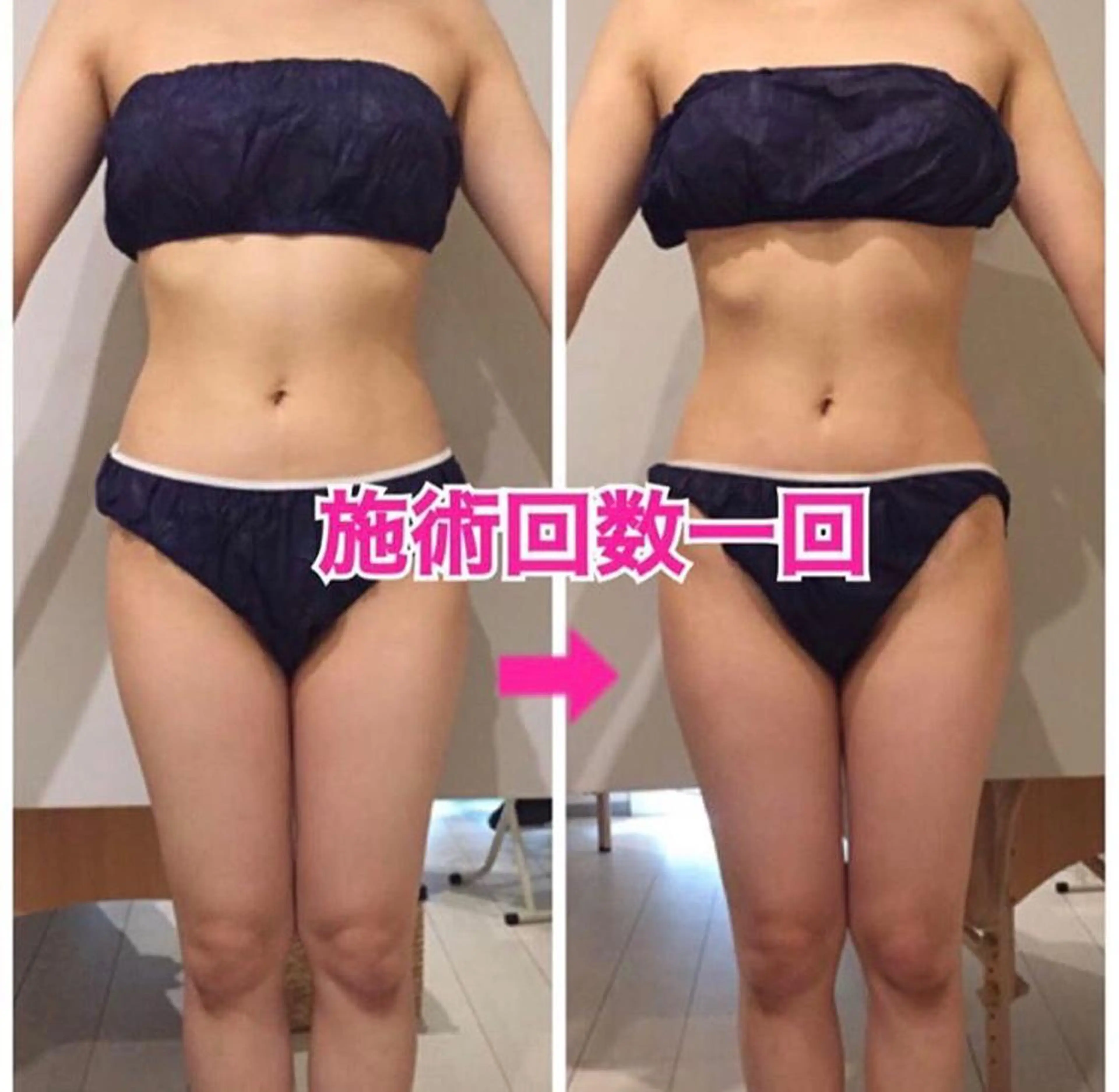 ショート カラー パーマ ヘアアレンジ メンズ キッズ ネイル マツエク・マツパ マットネイル 痩身&ボディ 結果出し🌟丹野のエステ・リラクイメージ