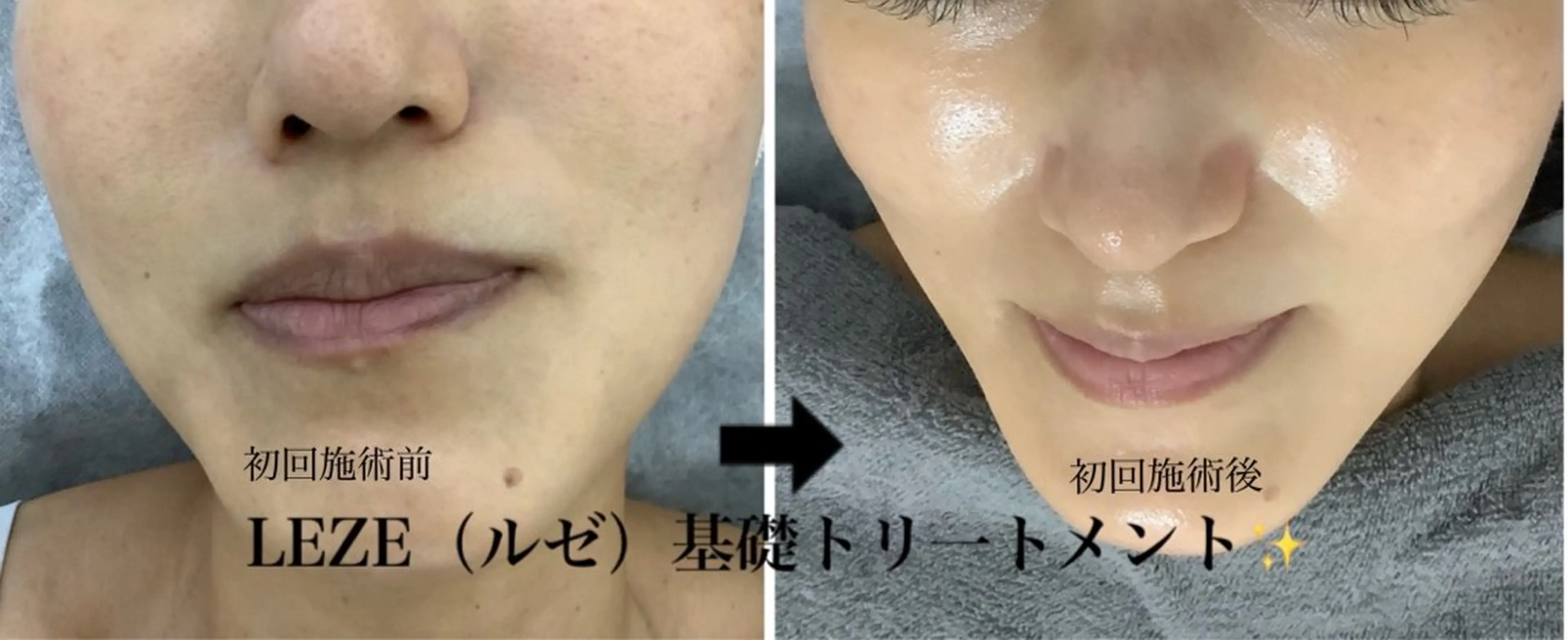 エステ 🩵Tatsumi Kana🩵のエステ・リラクイメージ