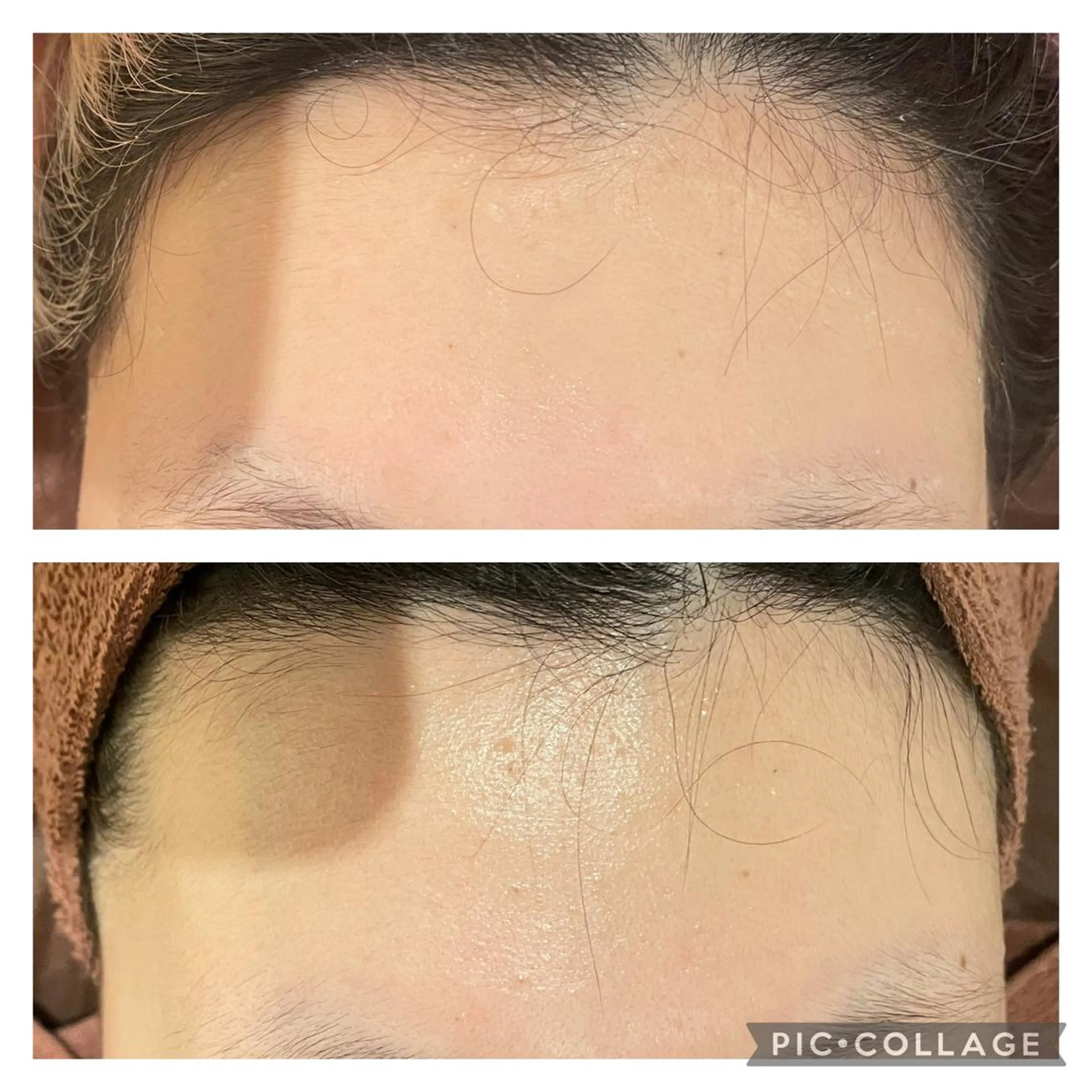 セミロング カラー パーマ ヘアアレンジ メンズ キッズ ネイル マツエク・マツパ アイブロウ エステ リラク ニキビ特化型エステ 🍋最短で肌質改善のエステ・リラクイメージ