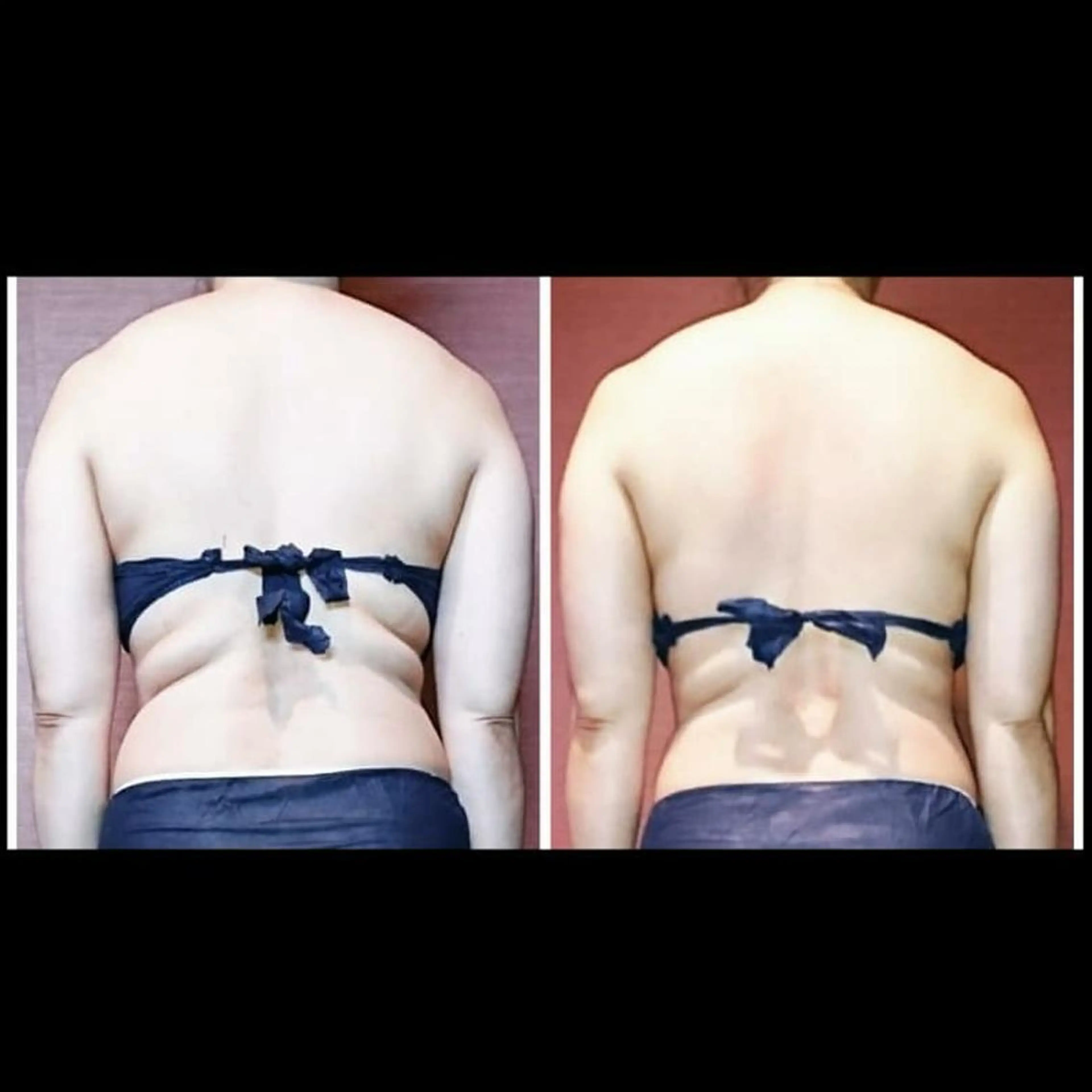 エステ リラク Nako  ﾅｺのエステ・リラクイメージ