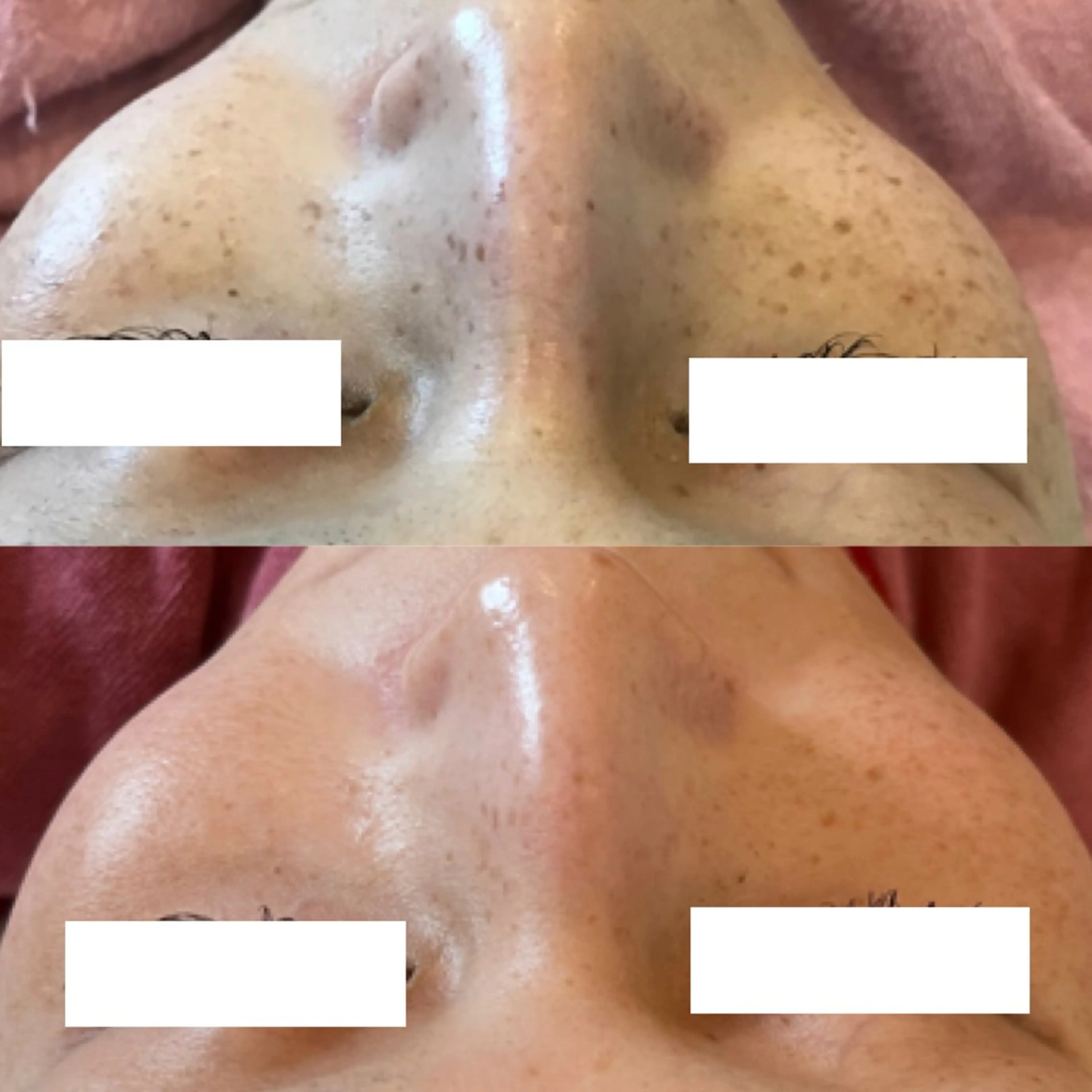 【しみ毛穴専門店】beautysalon Ankh所属・しみ毛穴専門店 Ankh 平田のエステ・リラクイメージ