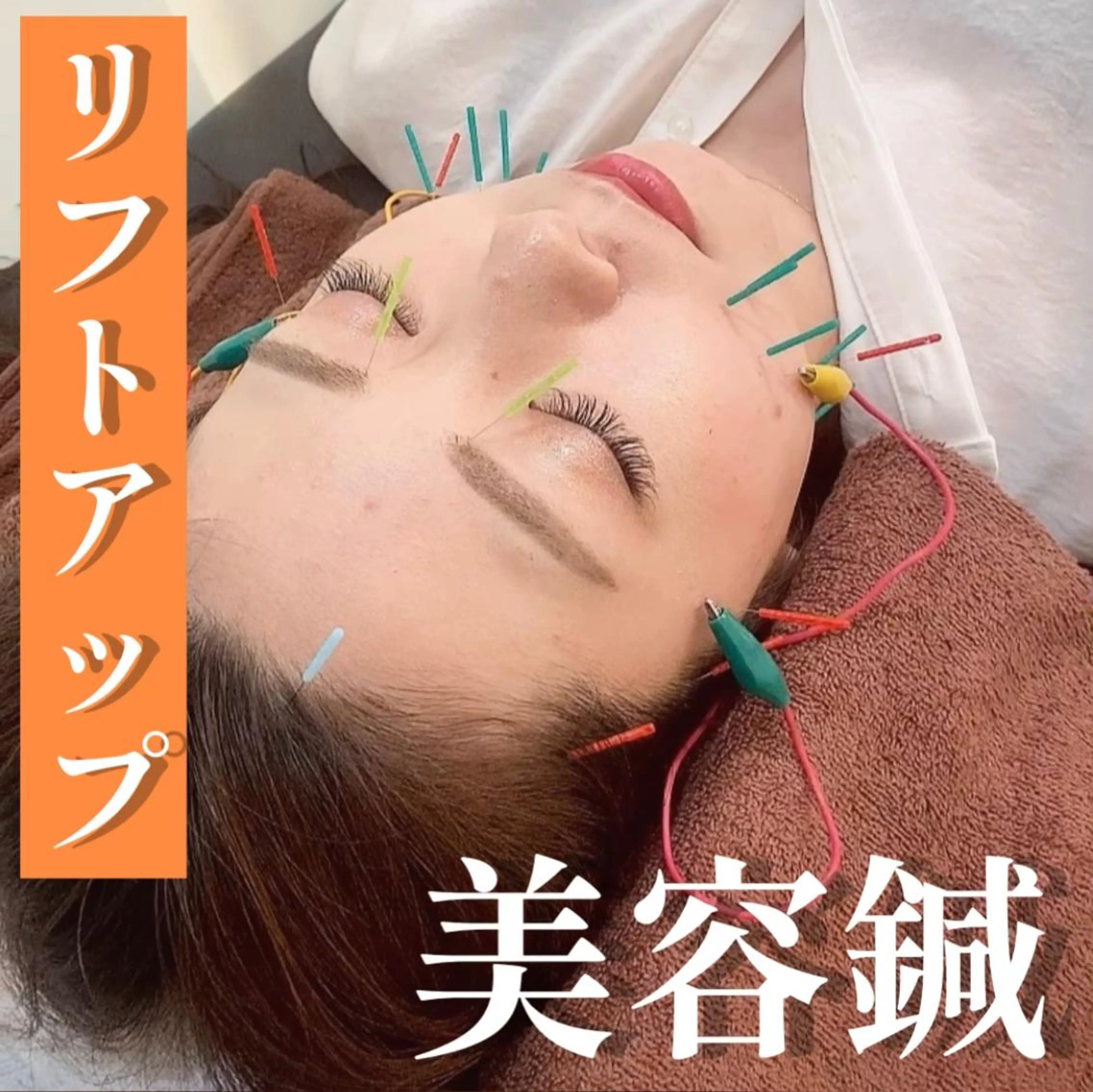 リフトアップ美容鍼🥰【電気美容鍼】が今ならお🉐に受けられます🪄《口コミ投稿で¥500オフ✨️》の写真