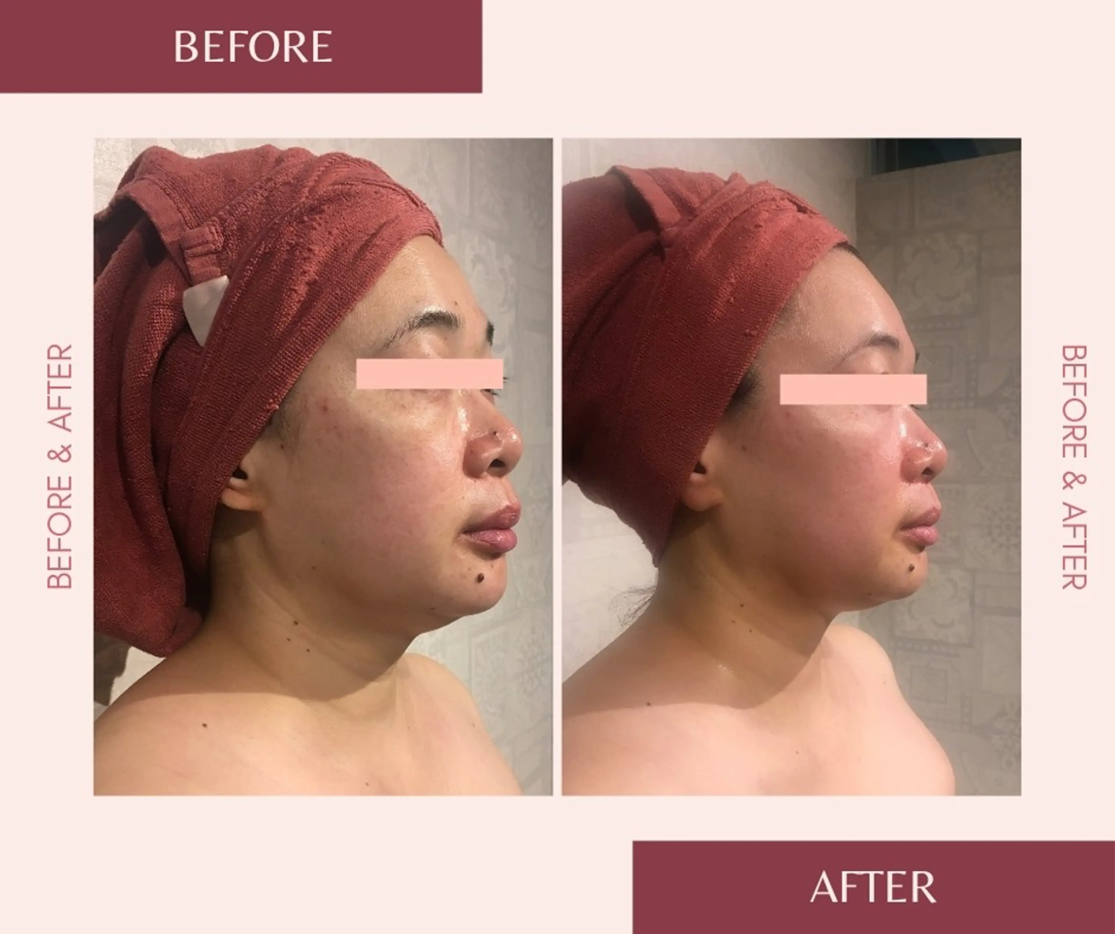 痩身・フェイシャル エステサンテボーテのエステ・リラクイメージ