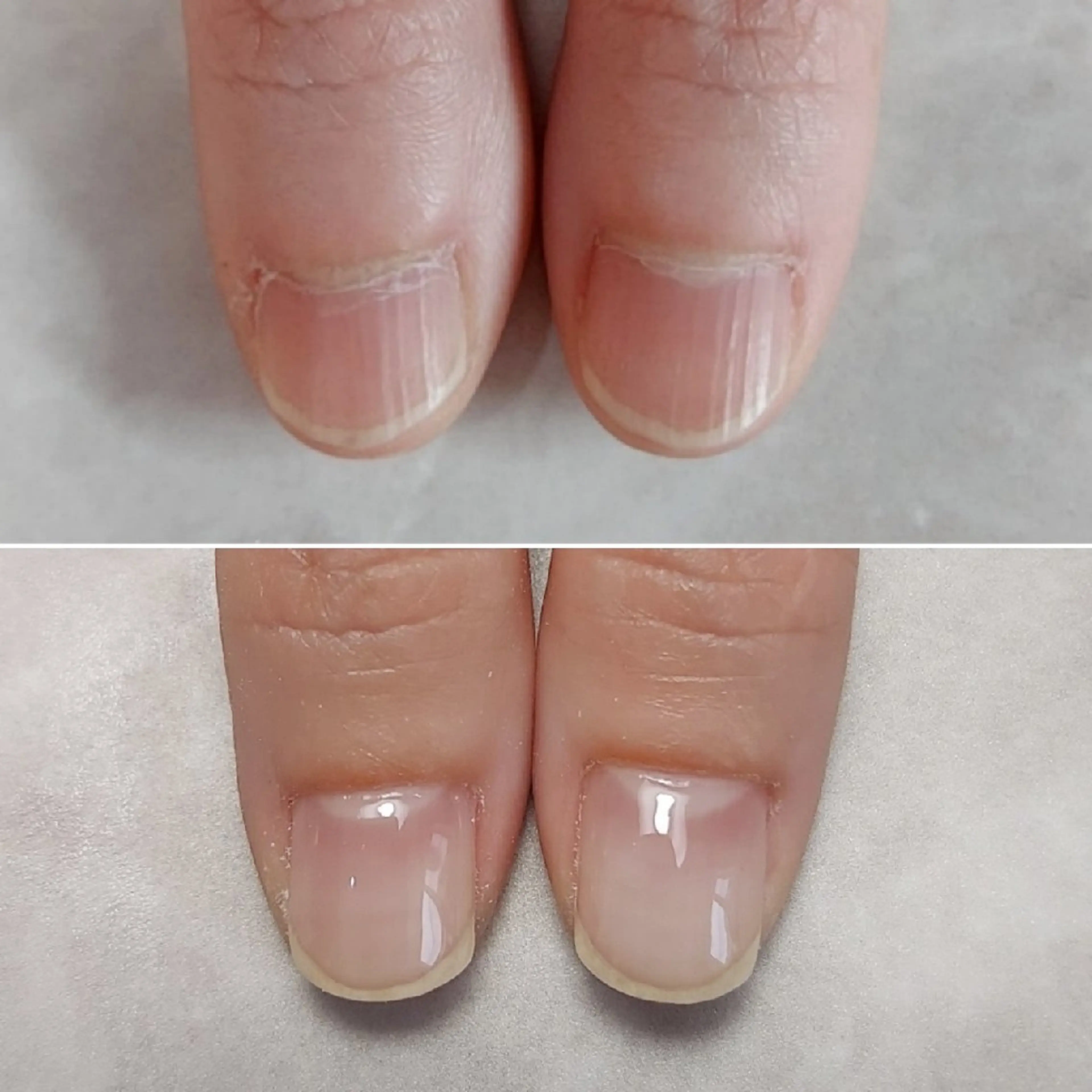 ジェル育成の写真