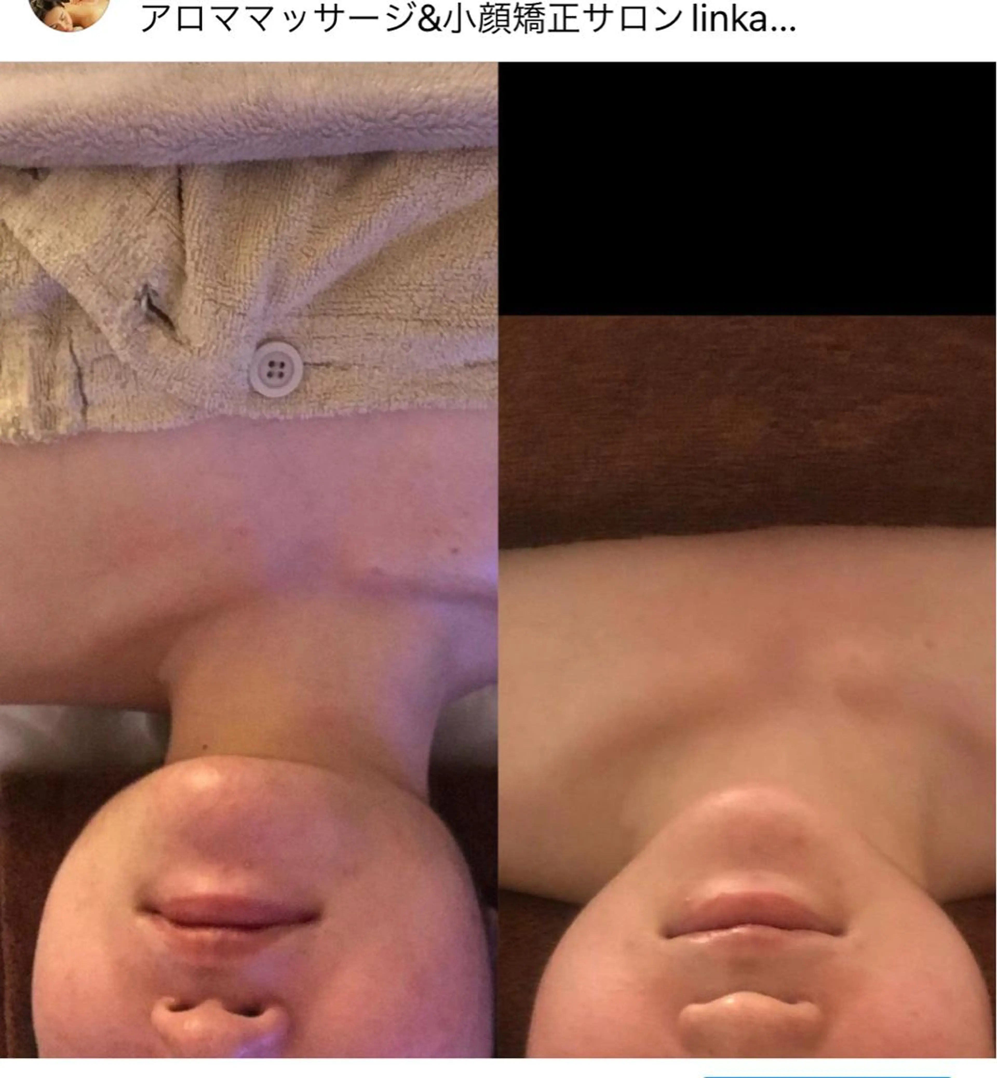 小顔コルギ＆よもぎ蒸しサロンLINKA所属・小顔＆美肌 サロンLINKAのエステ・リラクイメージ