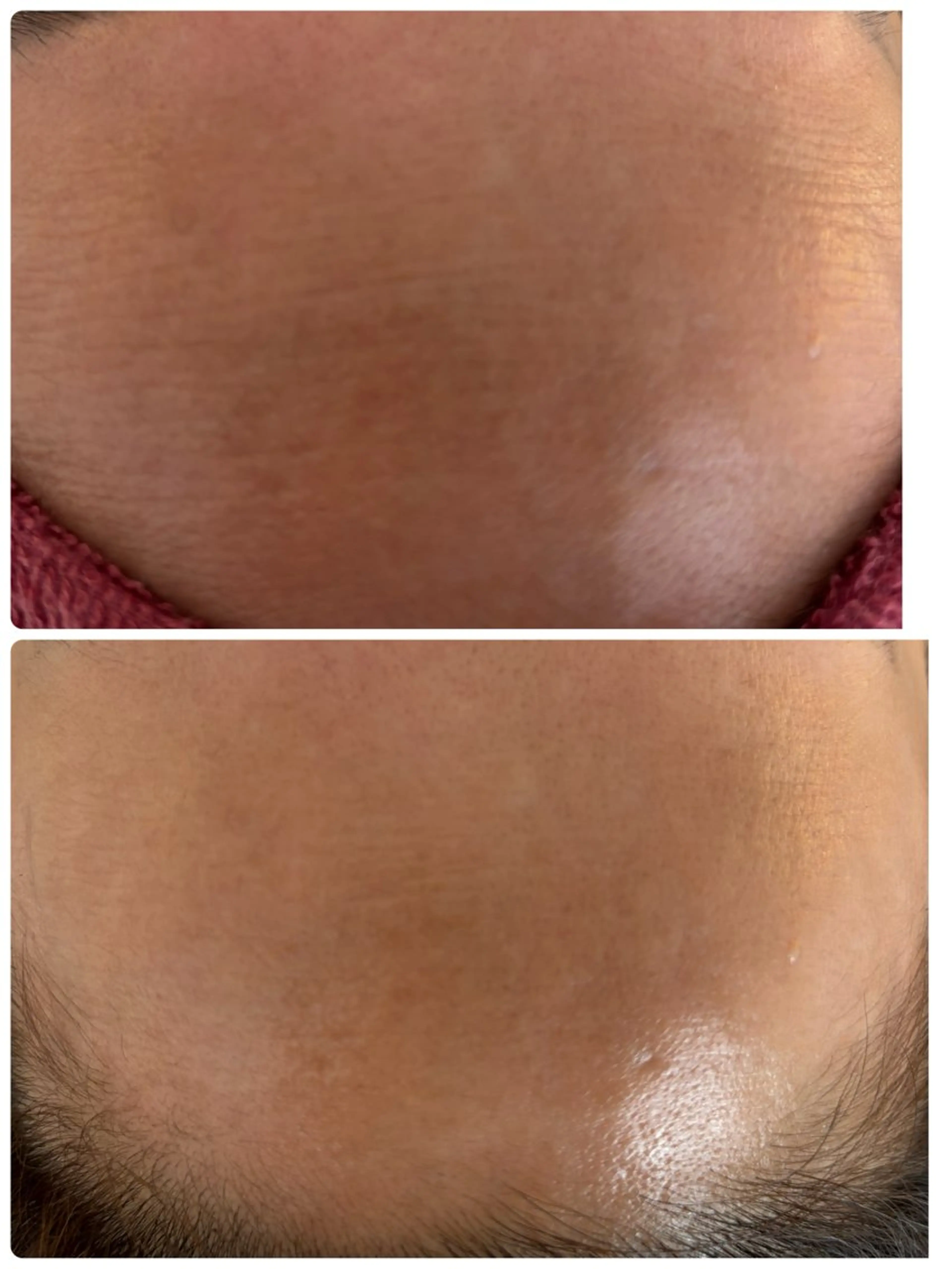 NAIL Salon Charmeのエステ・リラクイメージ