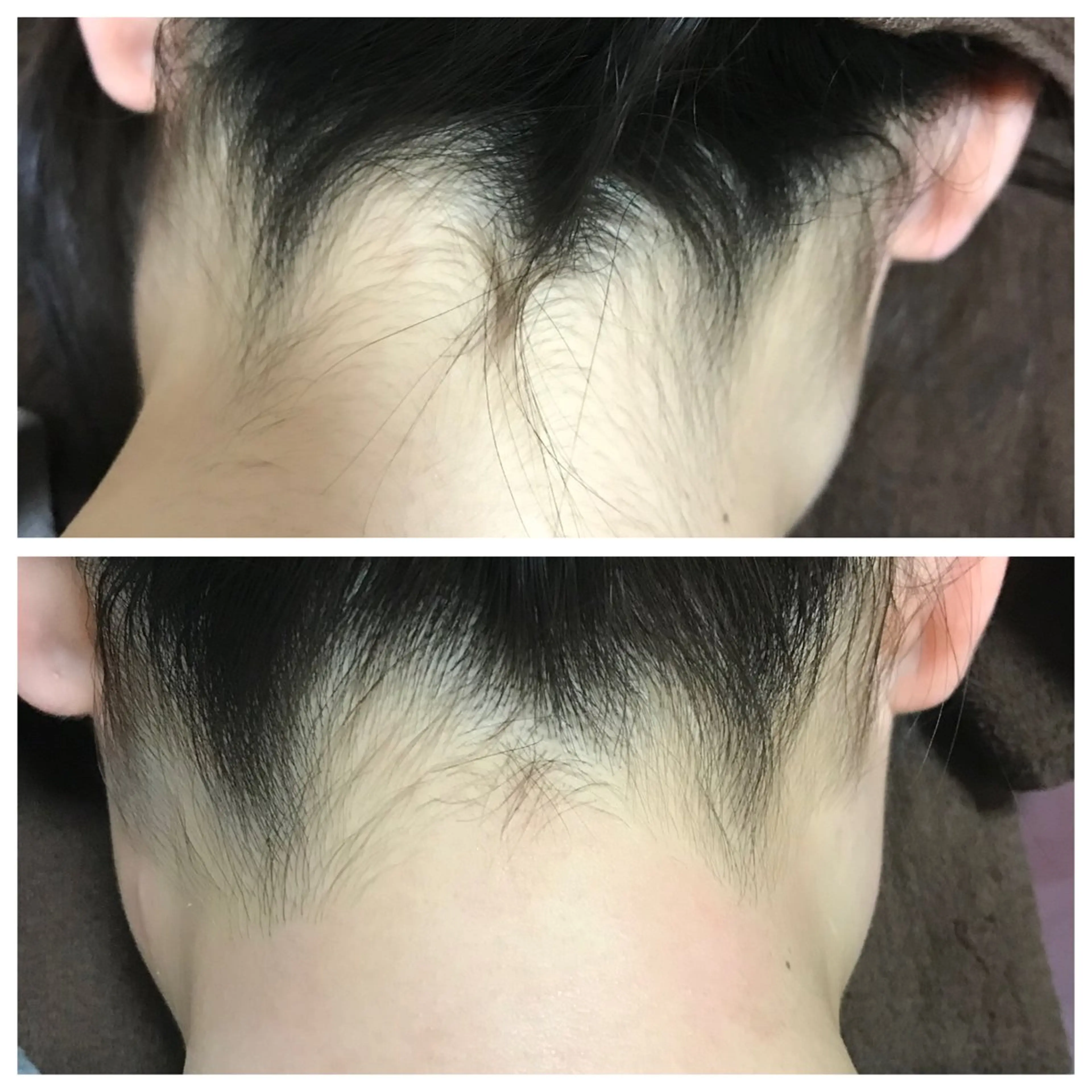 脱毛 Salon Improveのネイルデザイン