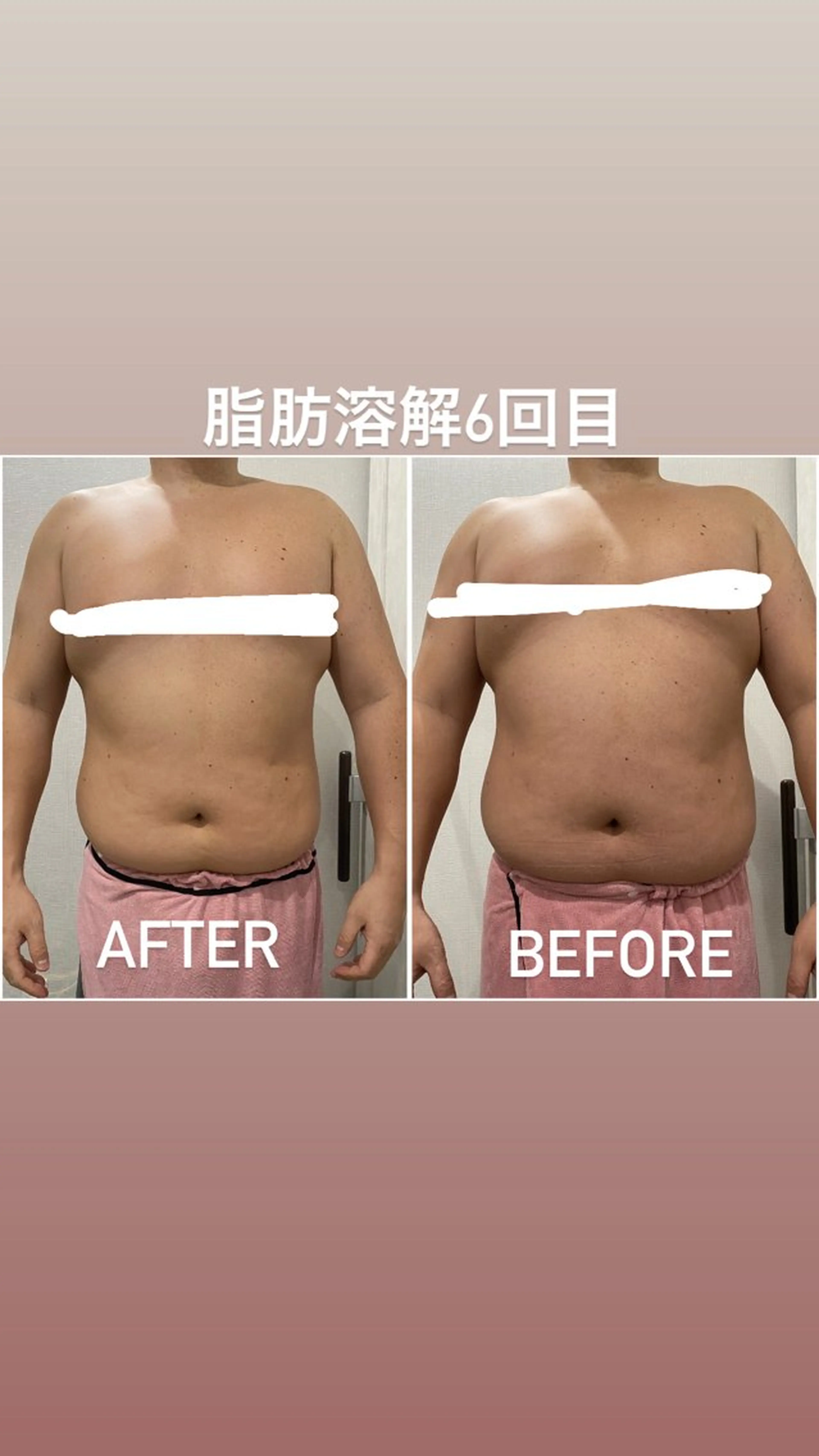 エステ 痩身/毛穴洗浄/脱毛 アルカンジュのエステ・リラクイメージ