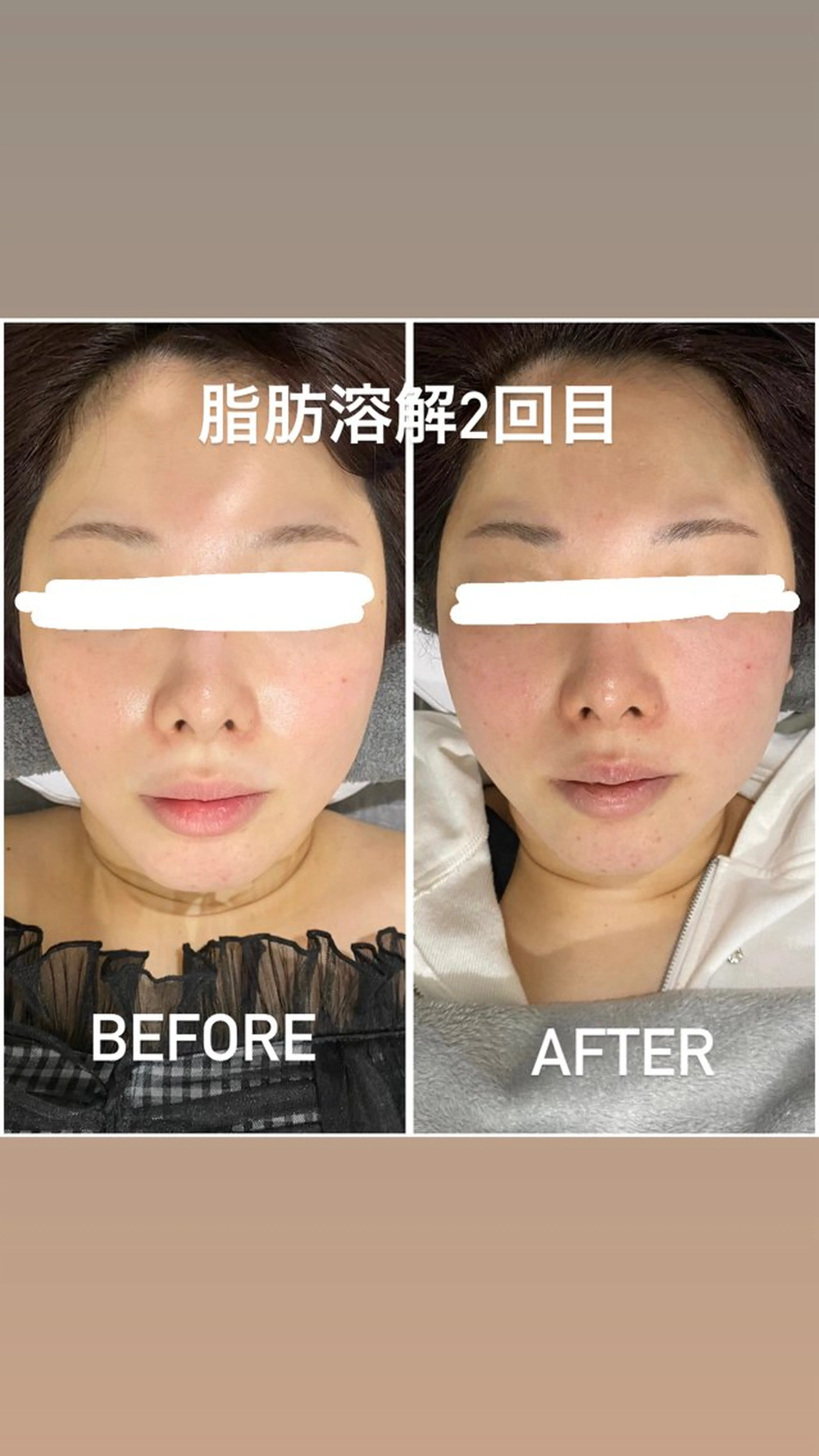 エステ 毛穴洗浄・痩身・脱毛 /アルカンジュのエステ・リラクイメージ