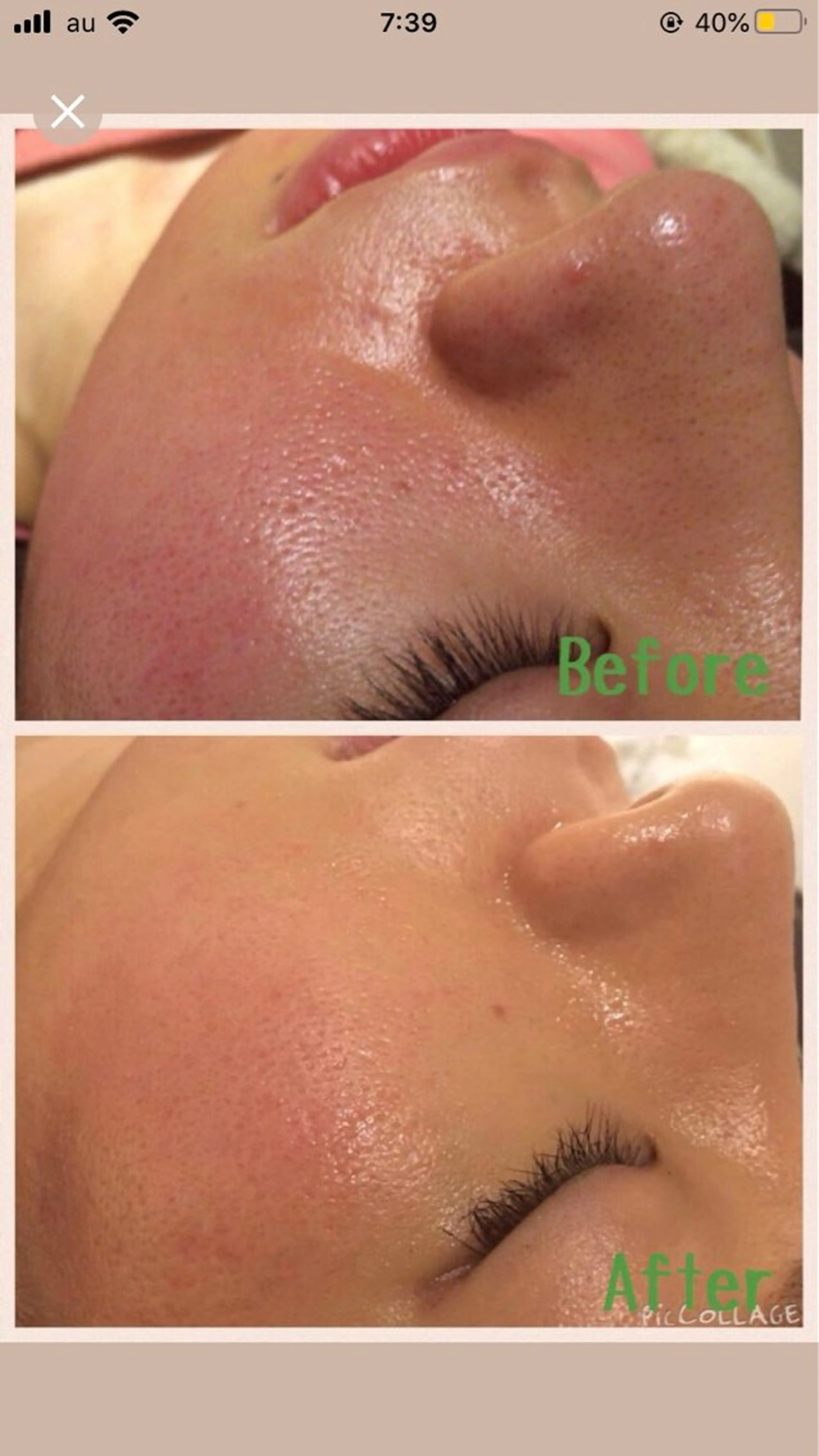 マツエク・マツパ アニメ,Vオタク× 即効痩せエステサロンのエステ・リラクイメージ