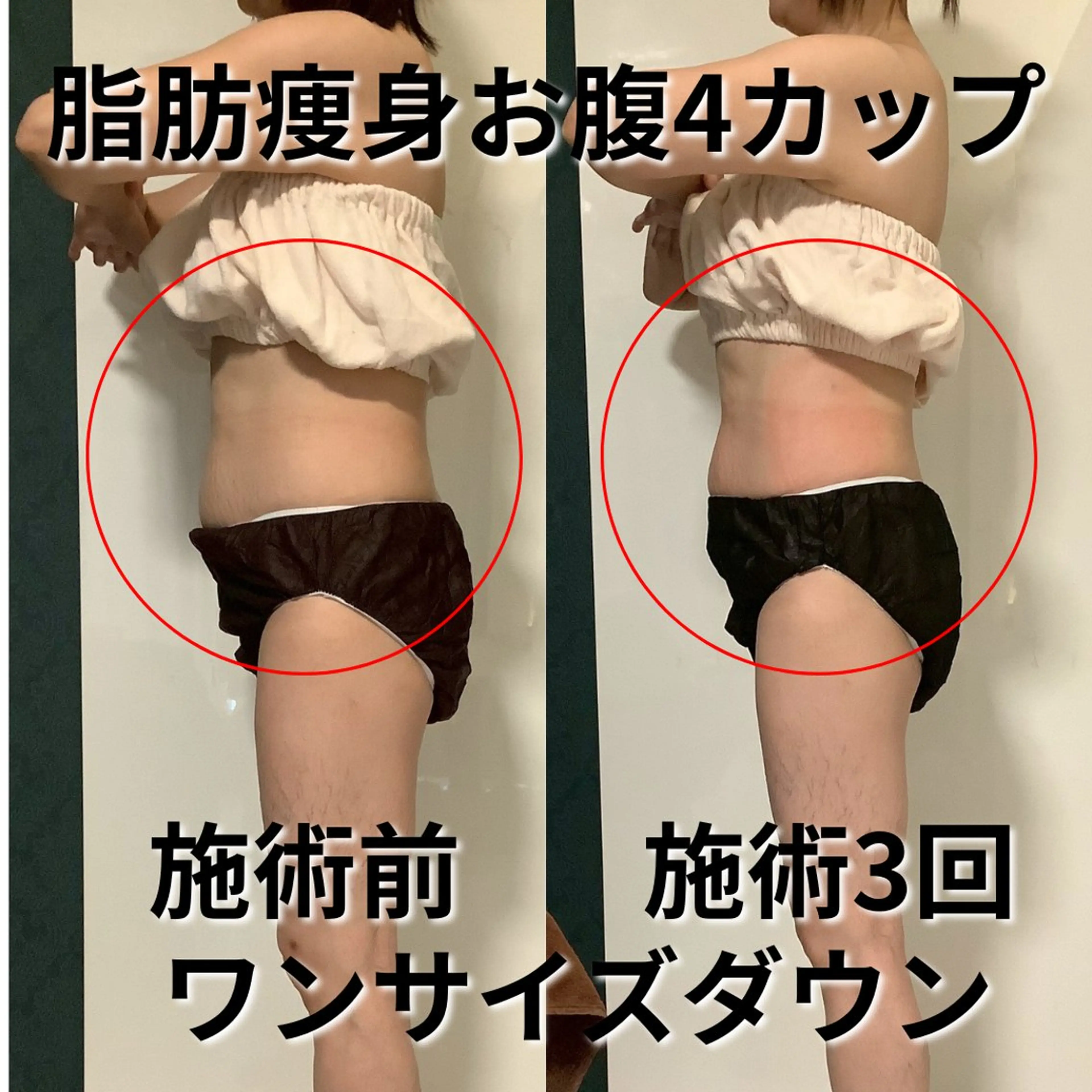 エステ 松居 舞のその他イメージ