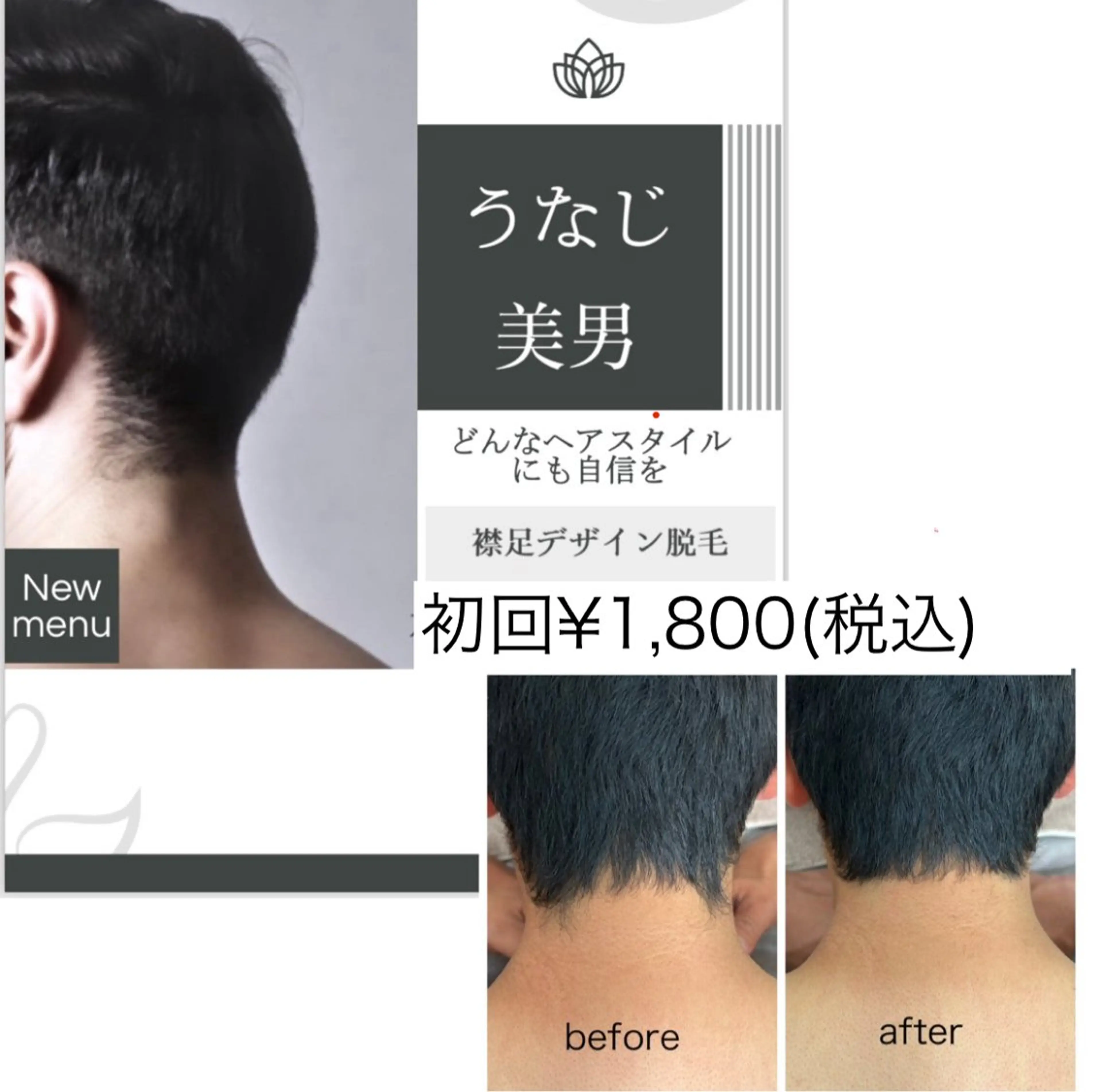 【メンズ限定】うなじ脱毛✨¥4000→1800の写真
