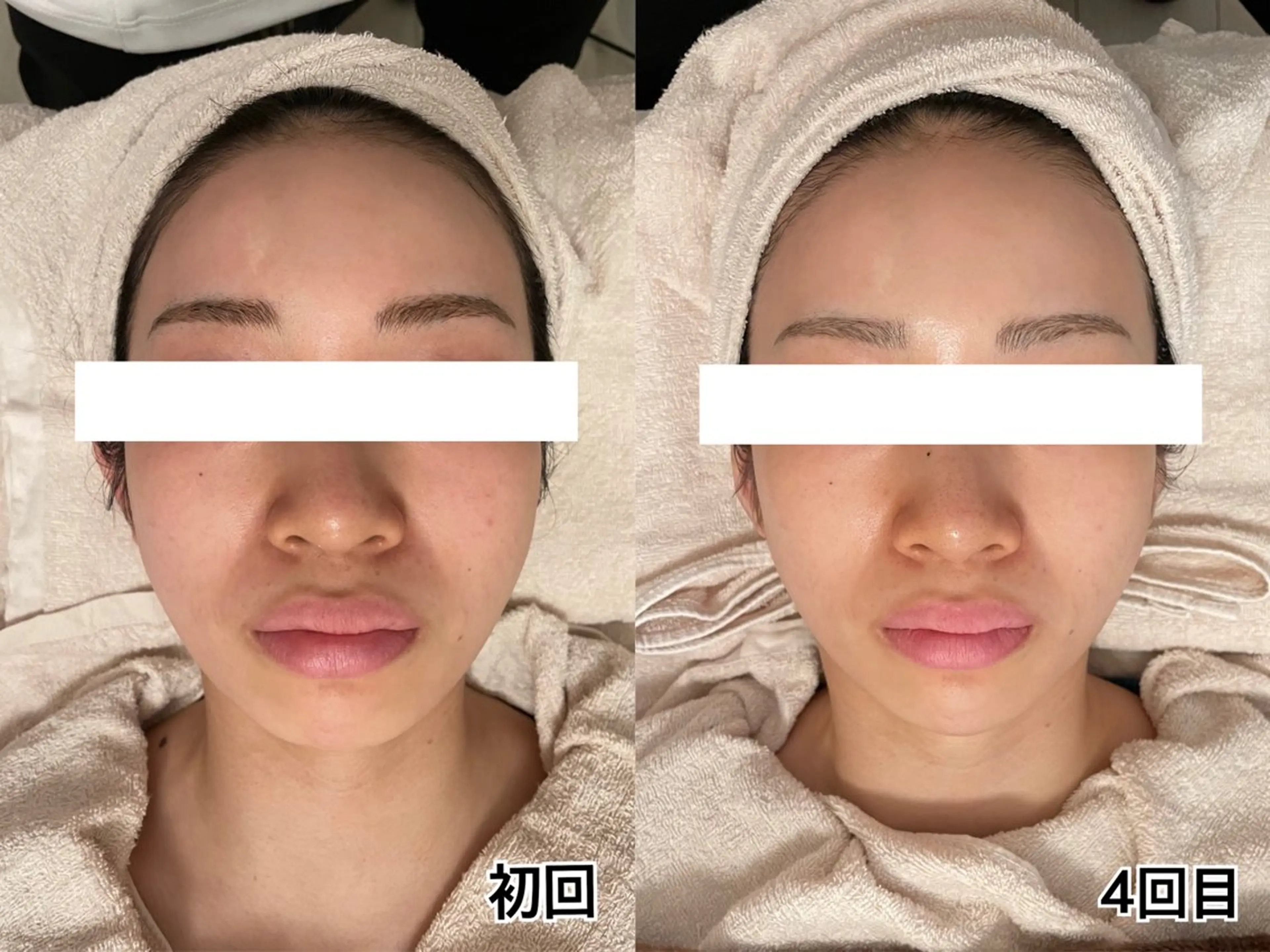 エステ ポテンツァ&針美容 バストアップ専門店のエステ・リラクイメージ