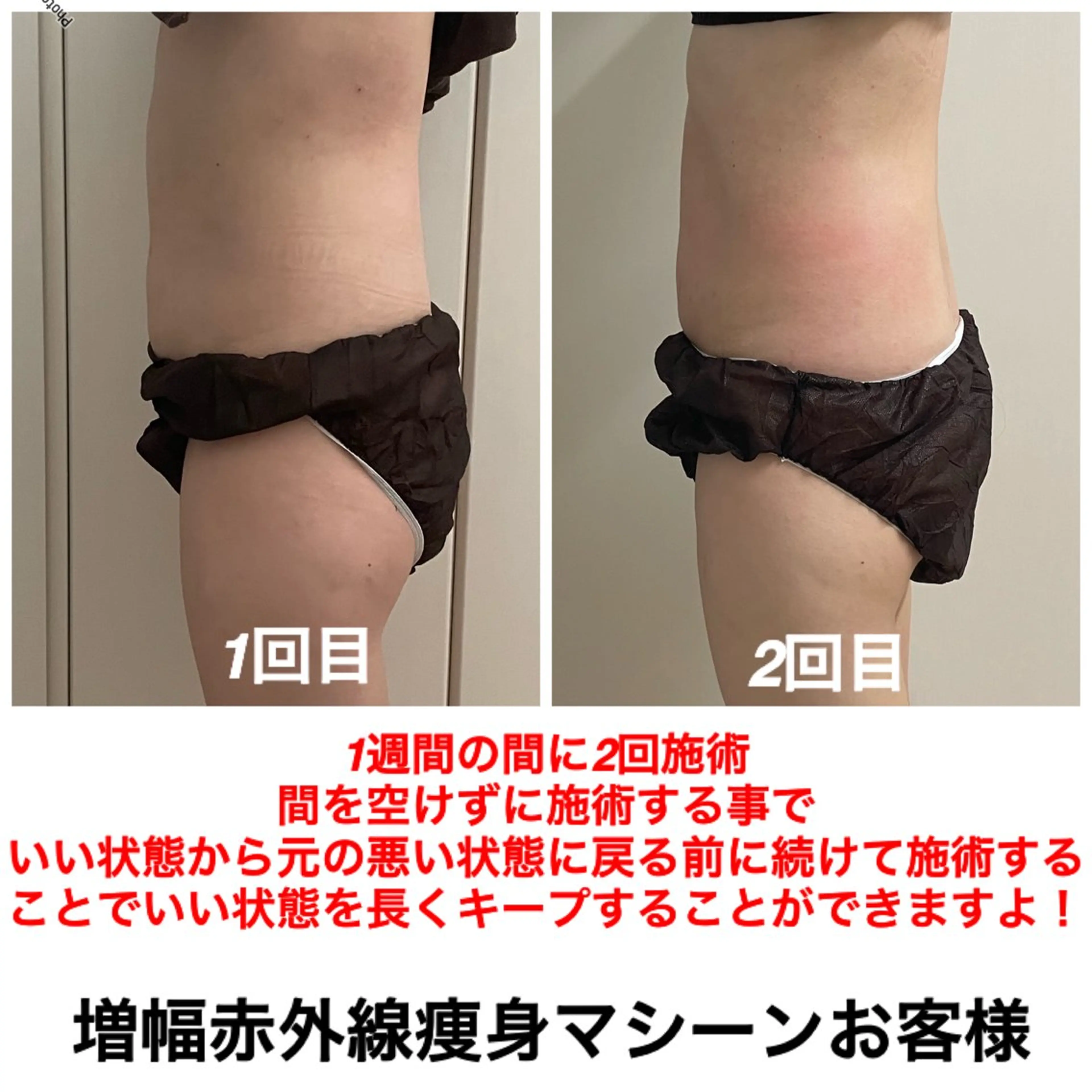 エステ ネイル・エステサロン UILANIのネイルデザイン