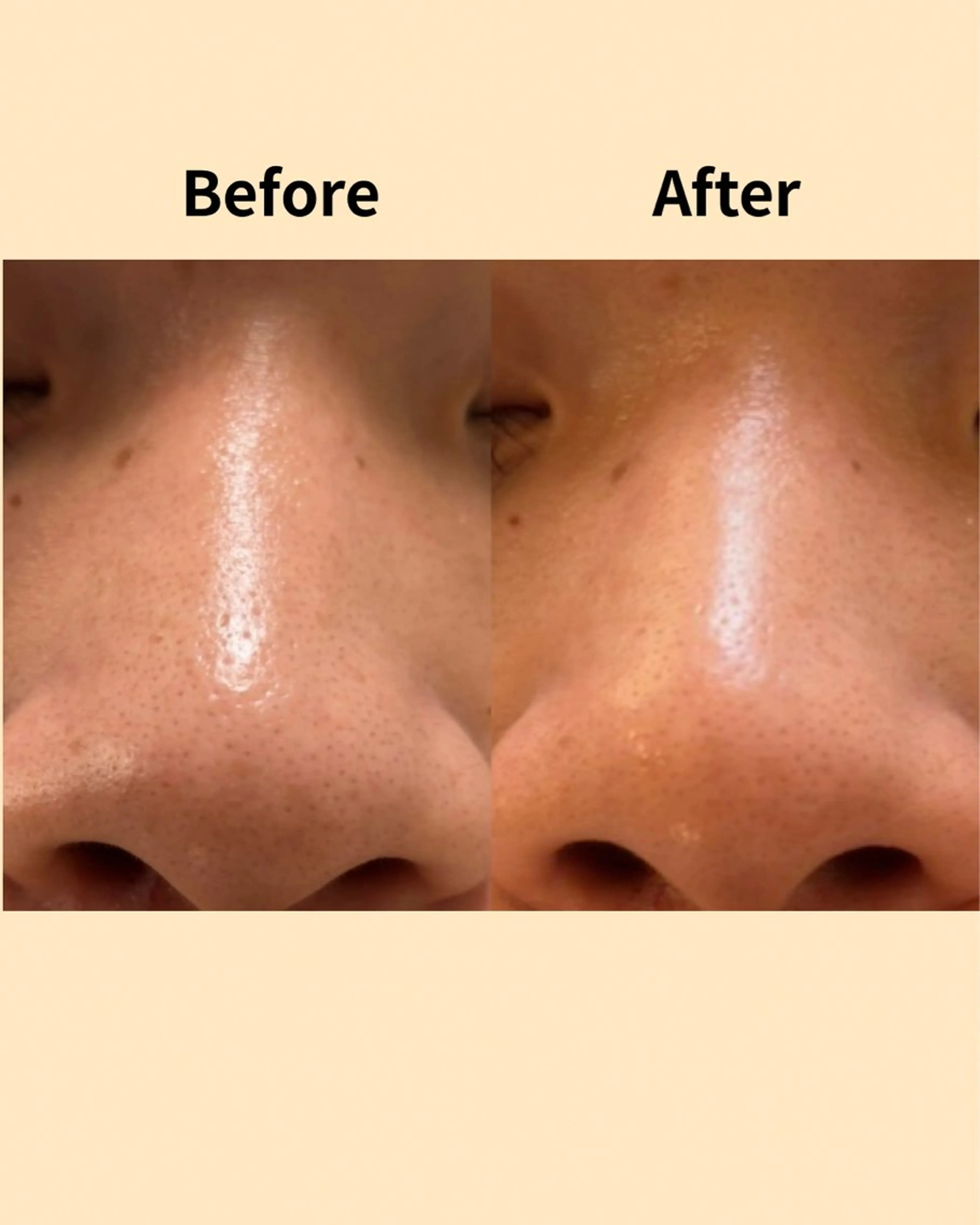 エステ nozomi.m🌷 narisのエステ・リラクイメージ