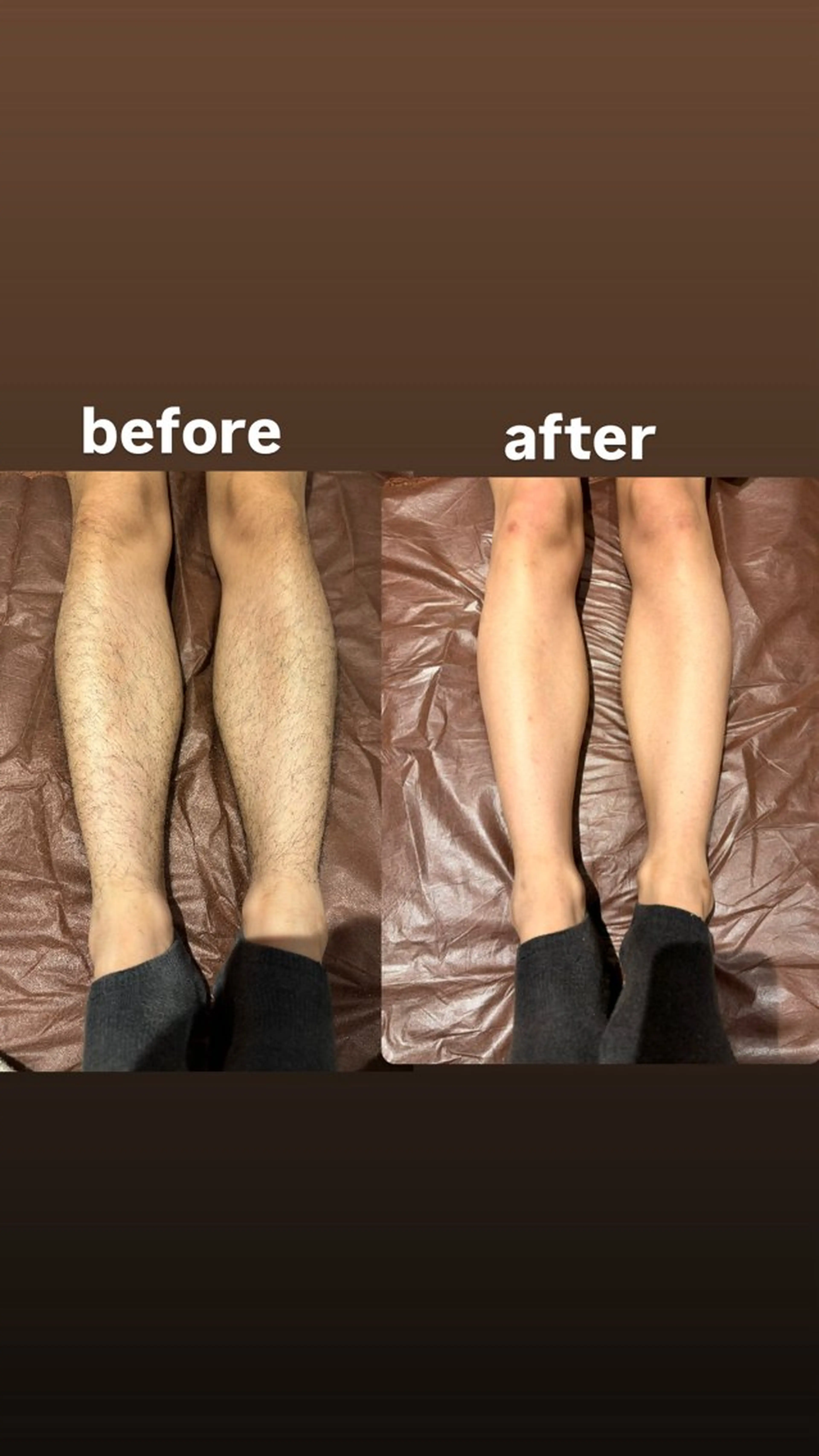 脱毛 re-born🎀 mihoのエステ・リラクイメージ