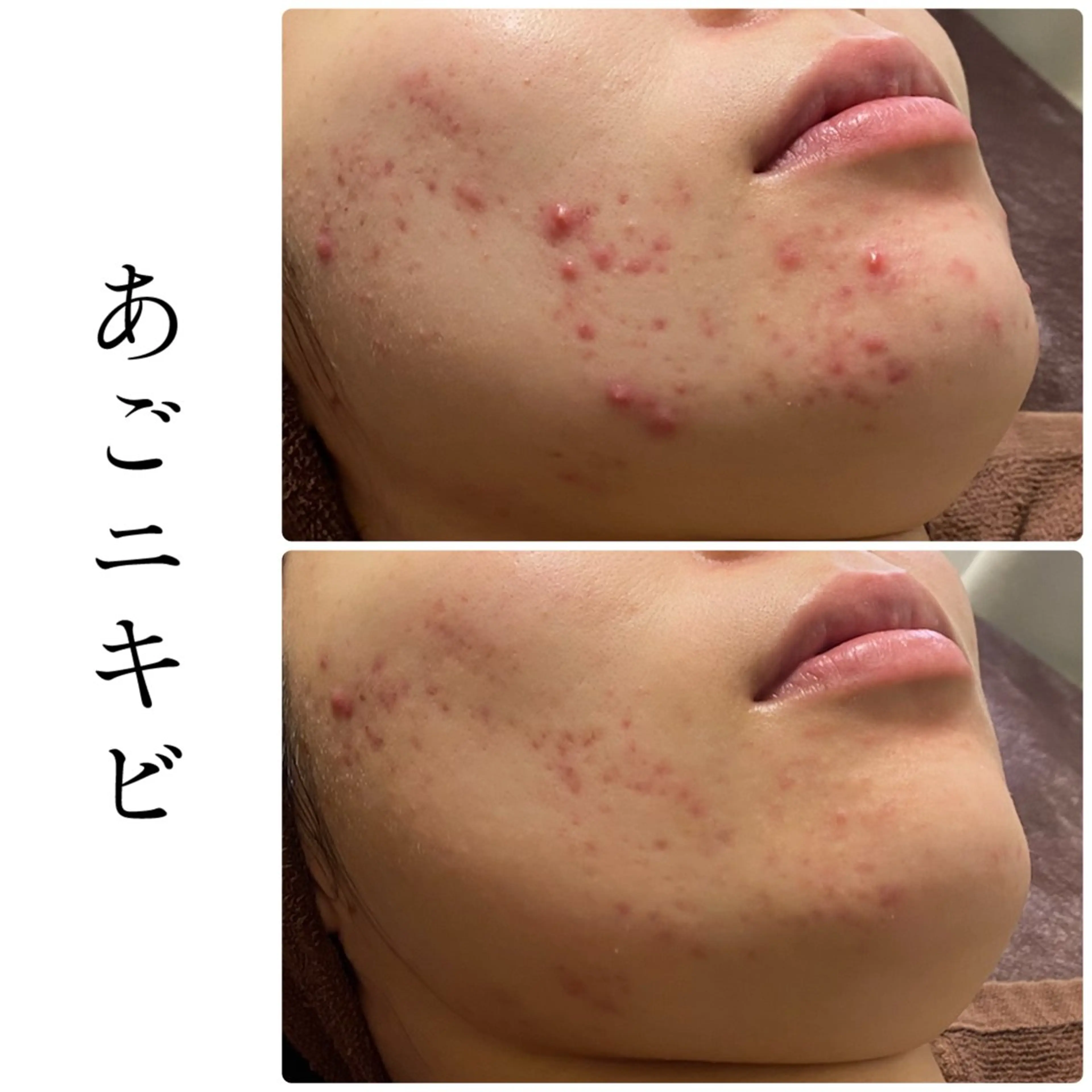 エステ ハーブピーリング専門 BIOEL横浜のエステ・リラクイメージ