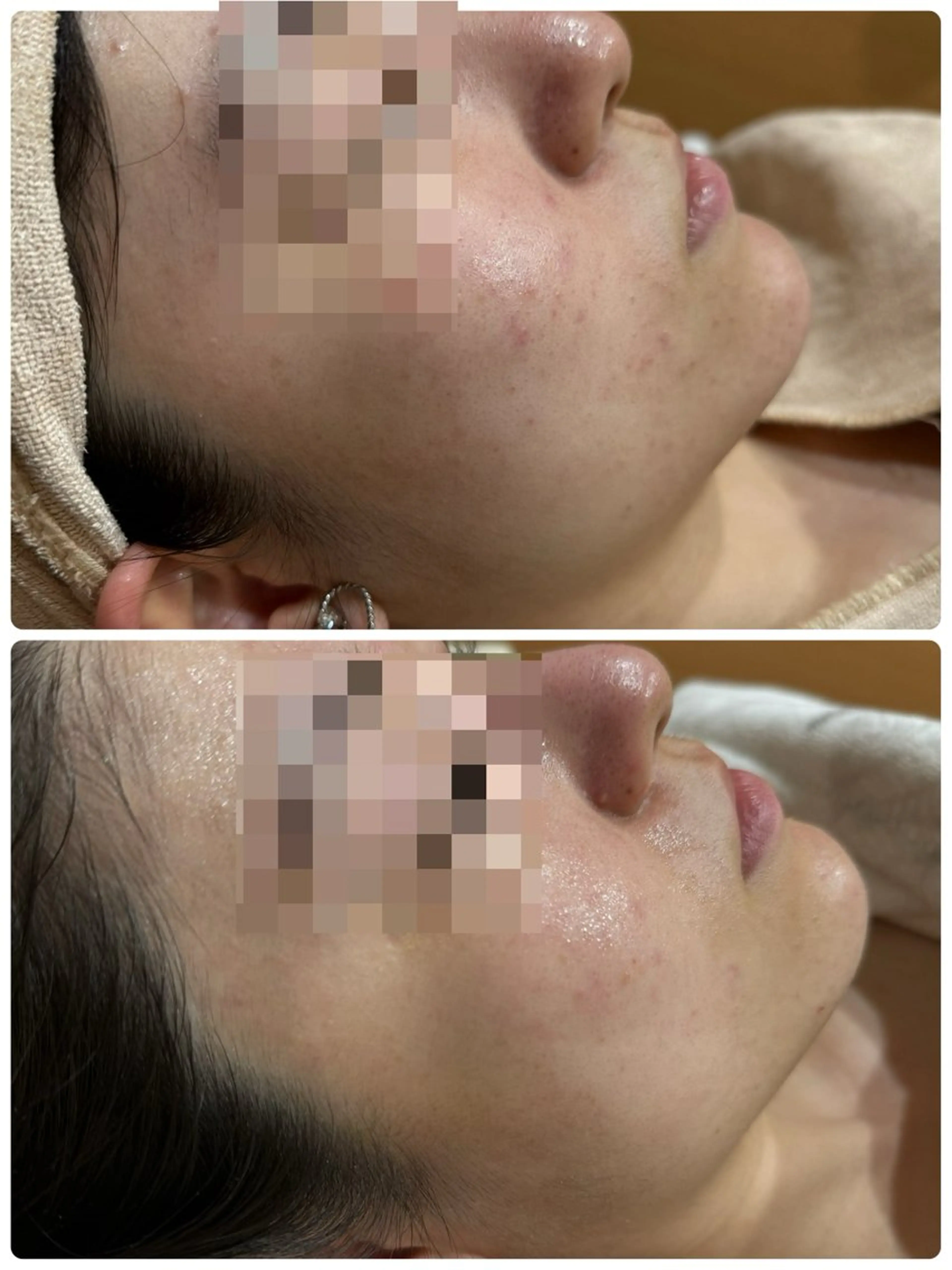 脱毛&フェイシャル 専門店muro.のエステ・リラクイメージ