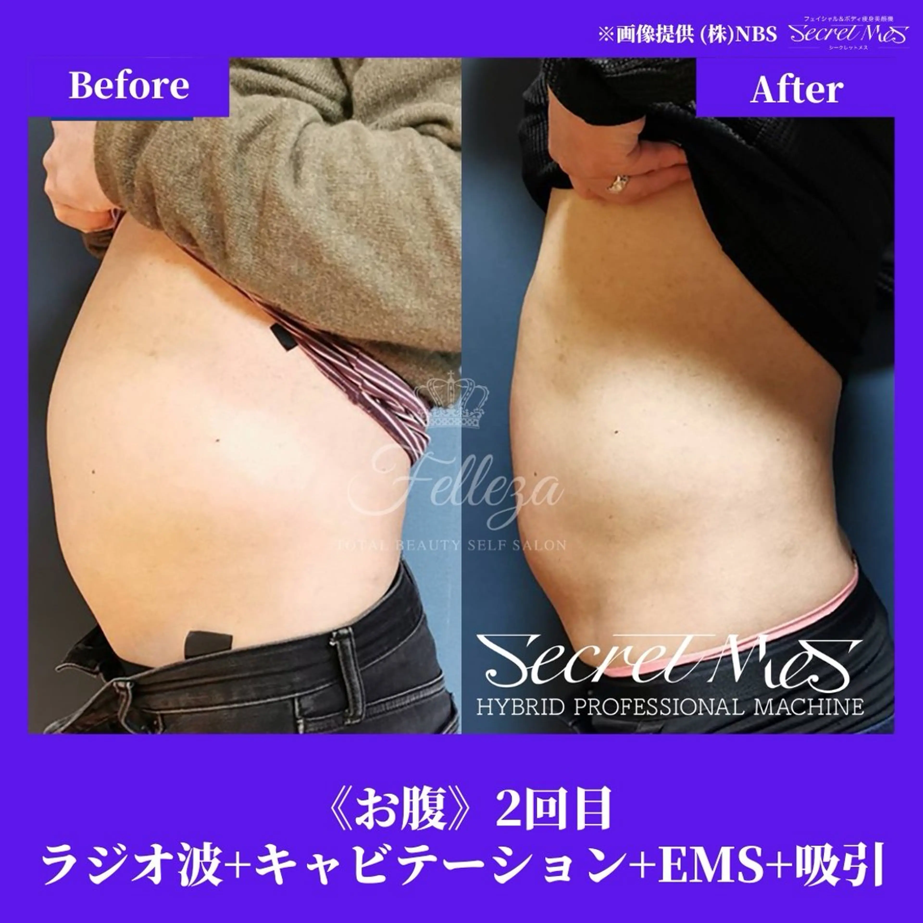 メンズ 有人型セルフサロン 脱毛／痩身／美顔のエステ・リラクイメージ