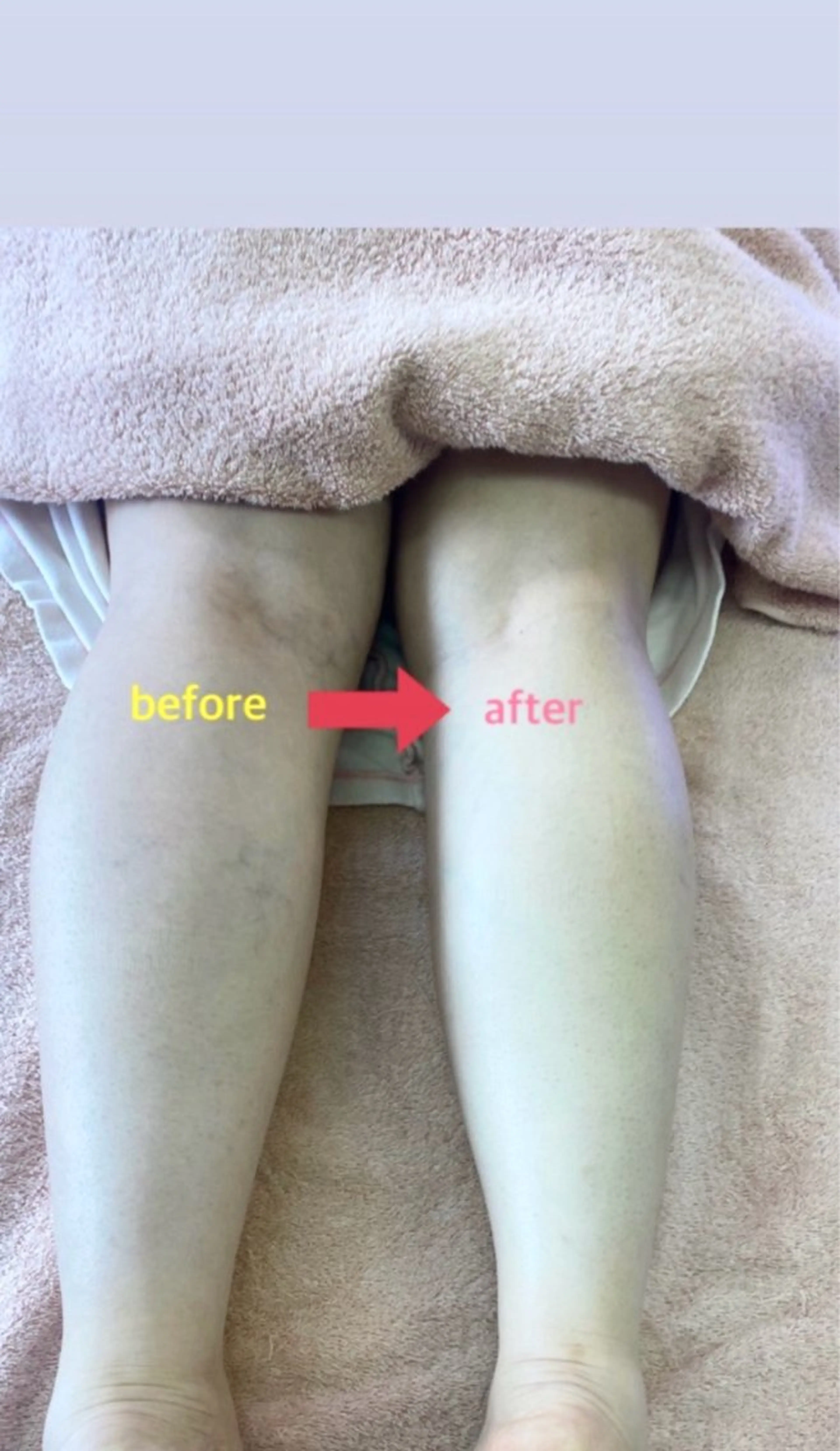 MARIRE EPISALONのエステ・リラクイメージ