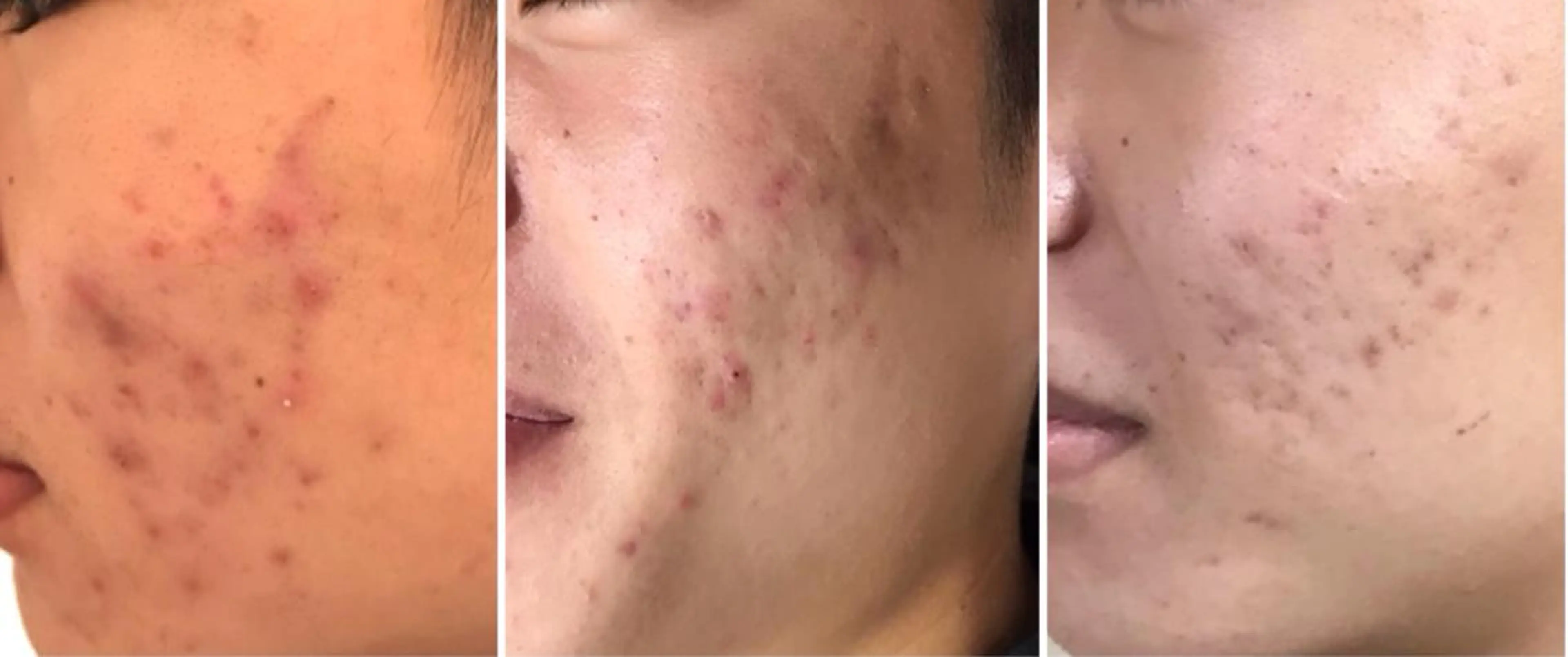 【EARTH鳥栖店】 小松美穂子のエステ・リラクイメージ