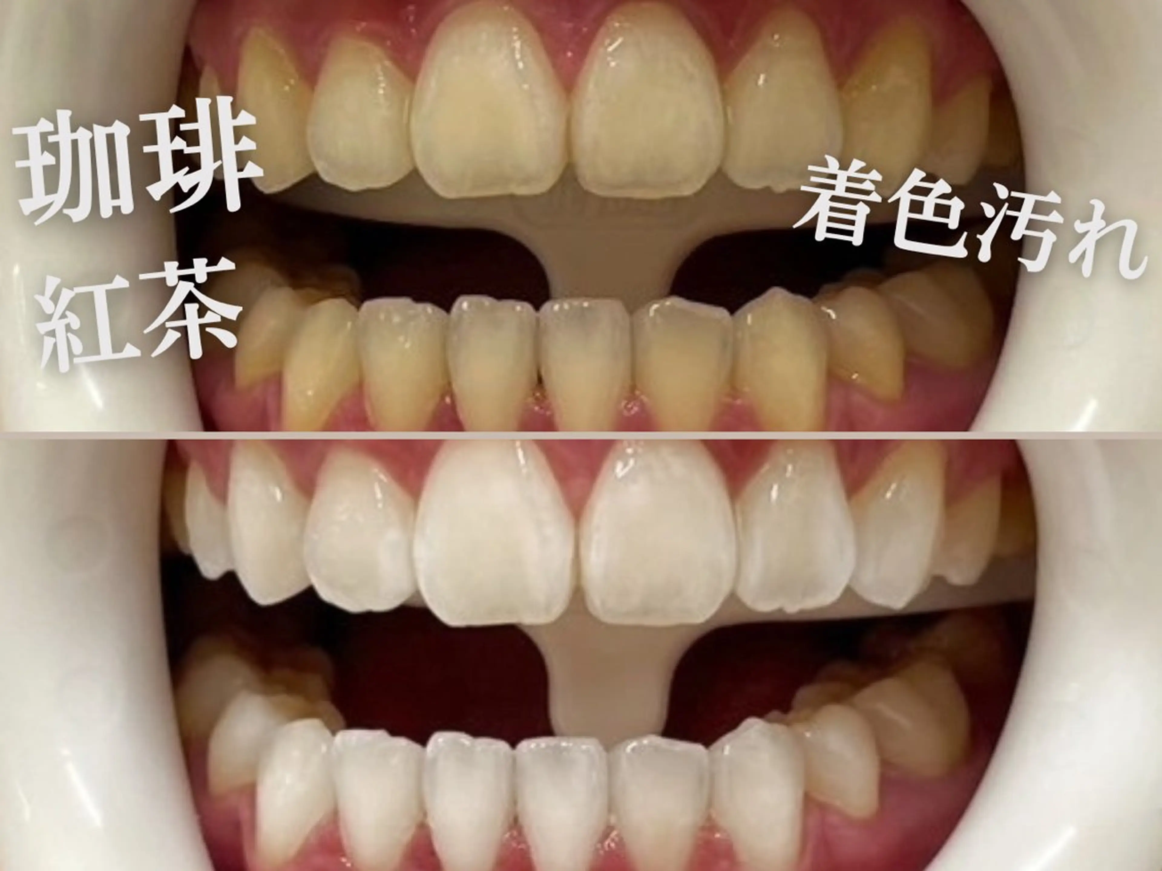 ホワイトニングサロン SARAのエステ・リラクイメージ