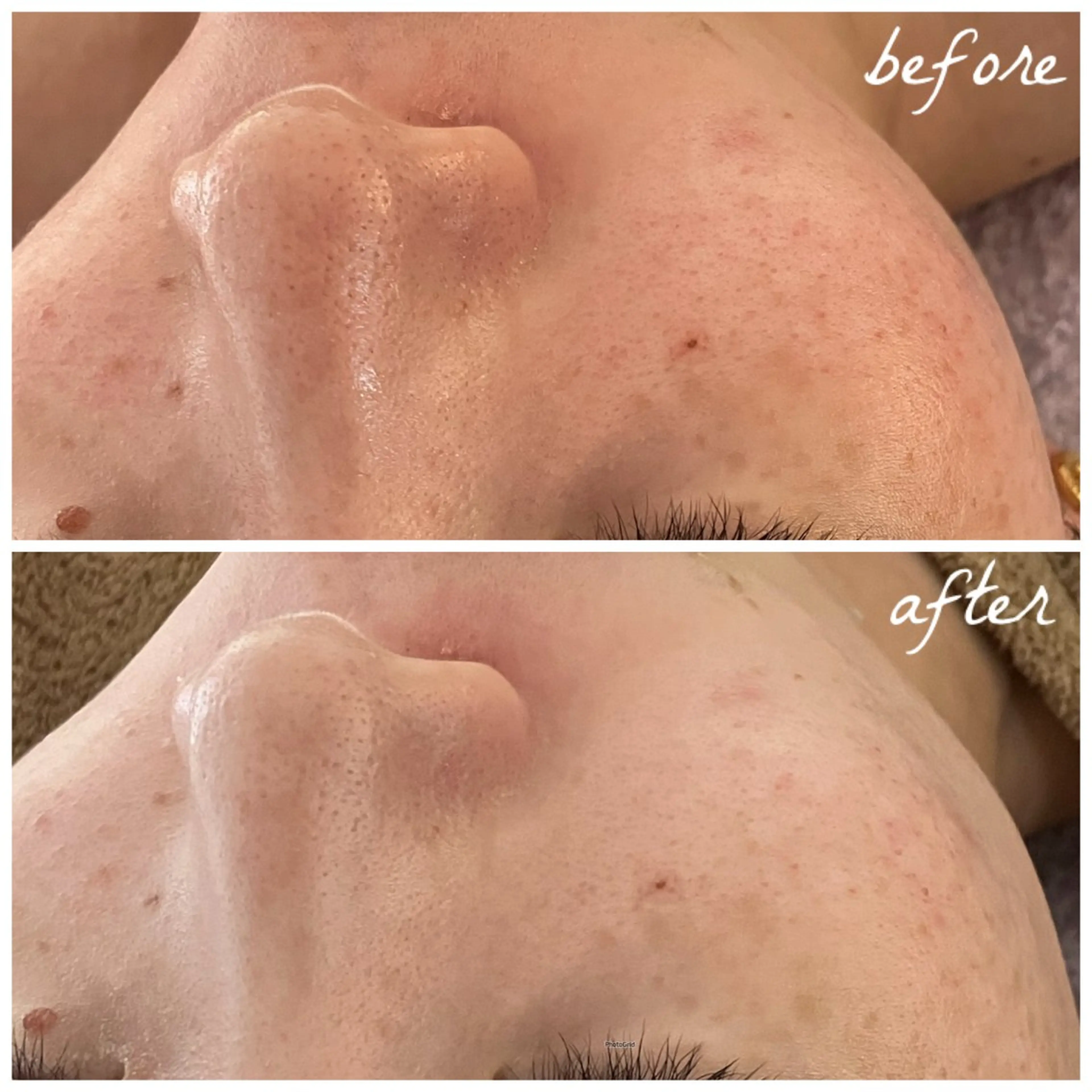 メンズ エステ メナード岐阜茜部 杉浦のエステ・リラクイメージ