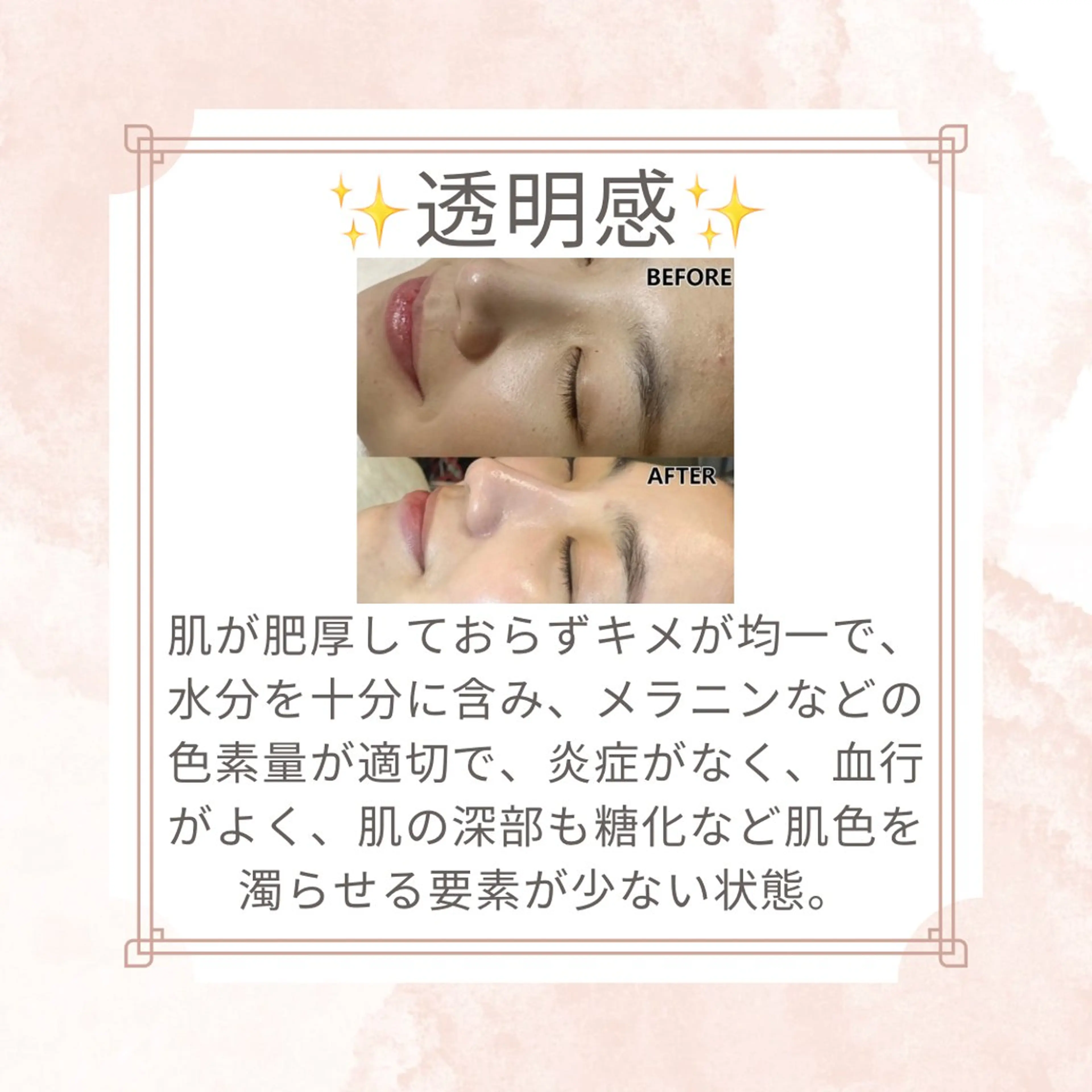 エステ リラク 愛維美水光美肌専門店 メンズレディースokのエステ・リラクイメージ