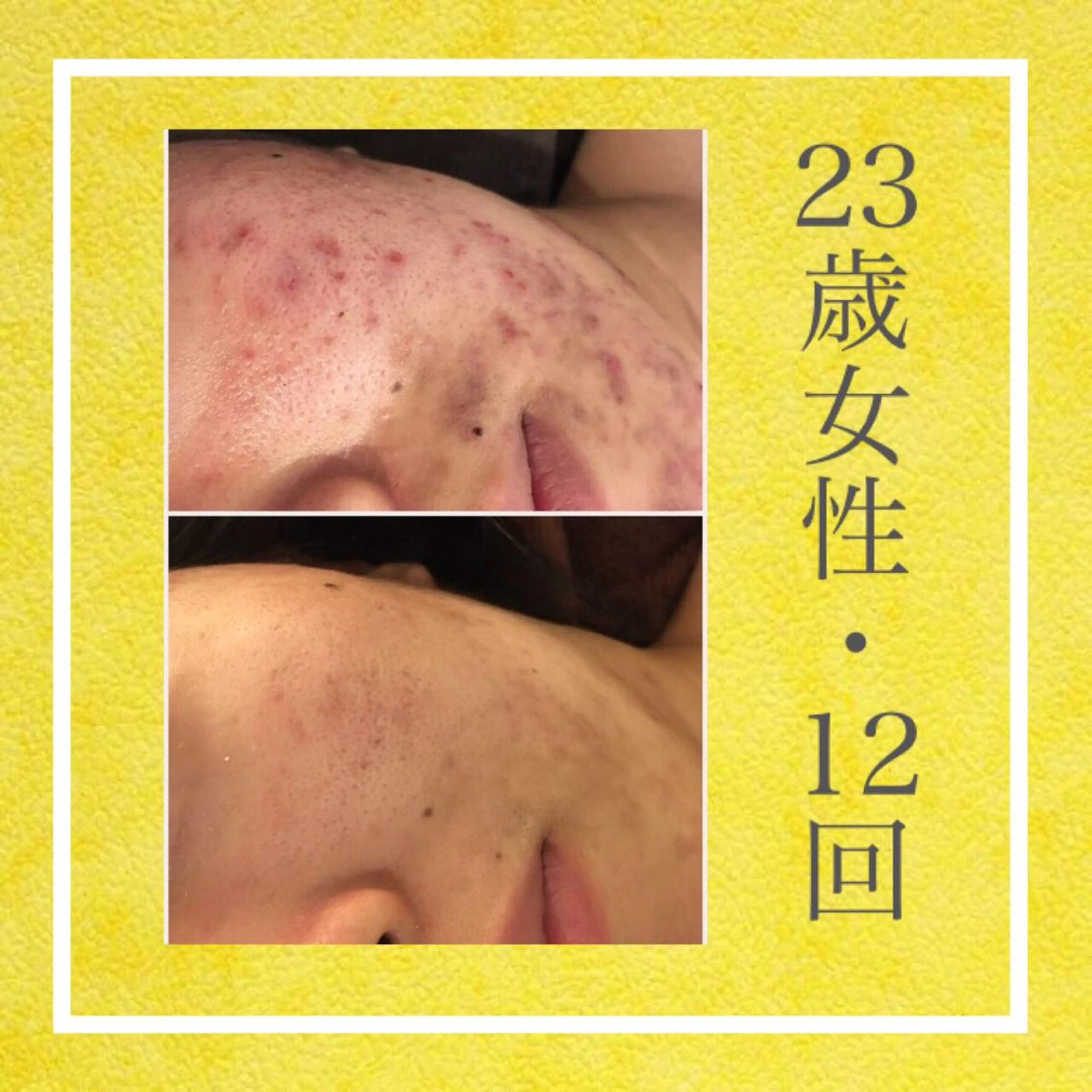 ミディアム カラー パーマ ヘアアレンジ メンズ キッズ ネイル マツエク・マツパ ニキビ・肌質改善専門 ♡人生が変わるサロンのエステ・リラクイメージ