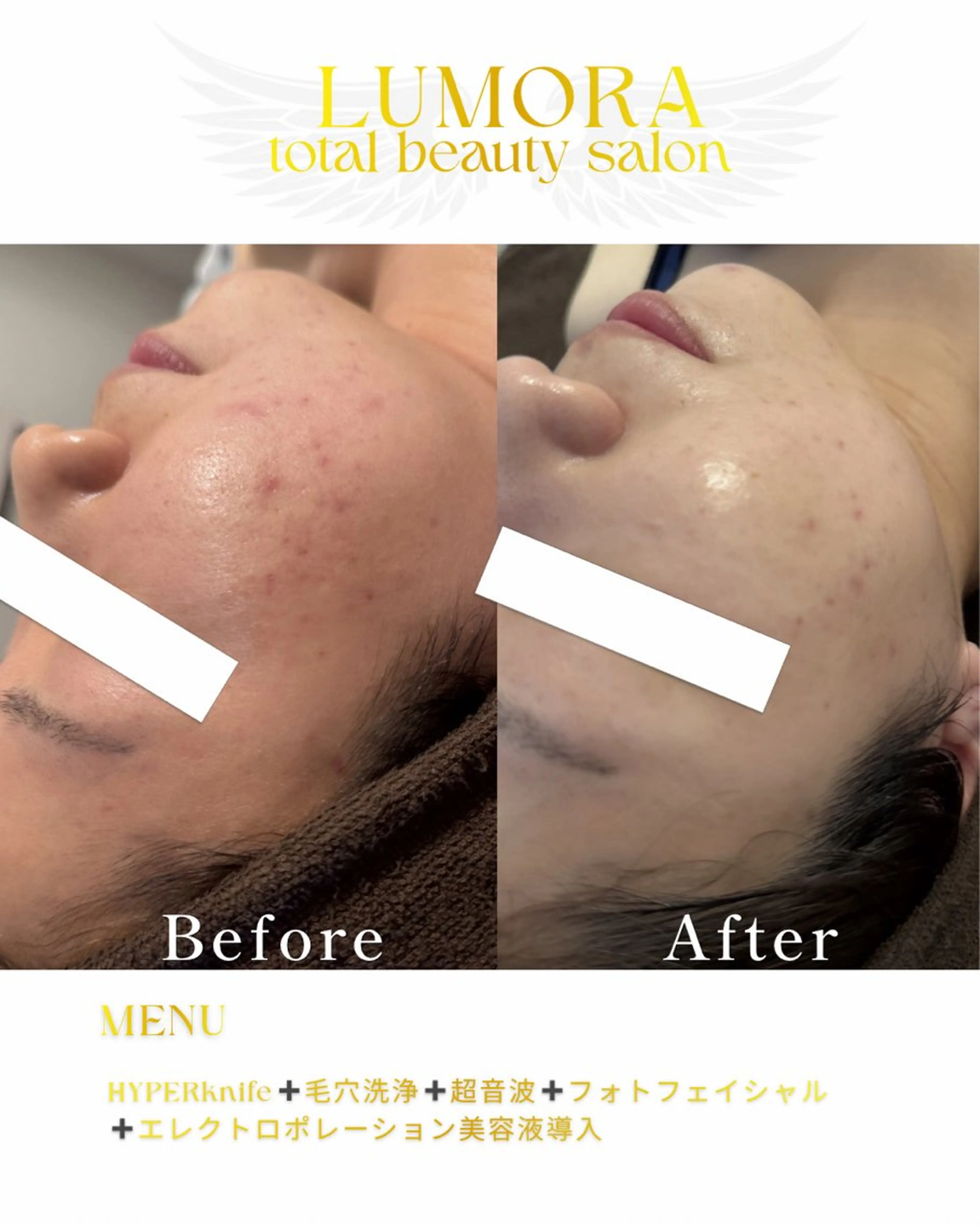 エステ リラク LUMORA🌟 トータルビューティーのエステ・リラクイメージ